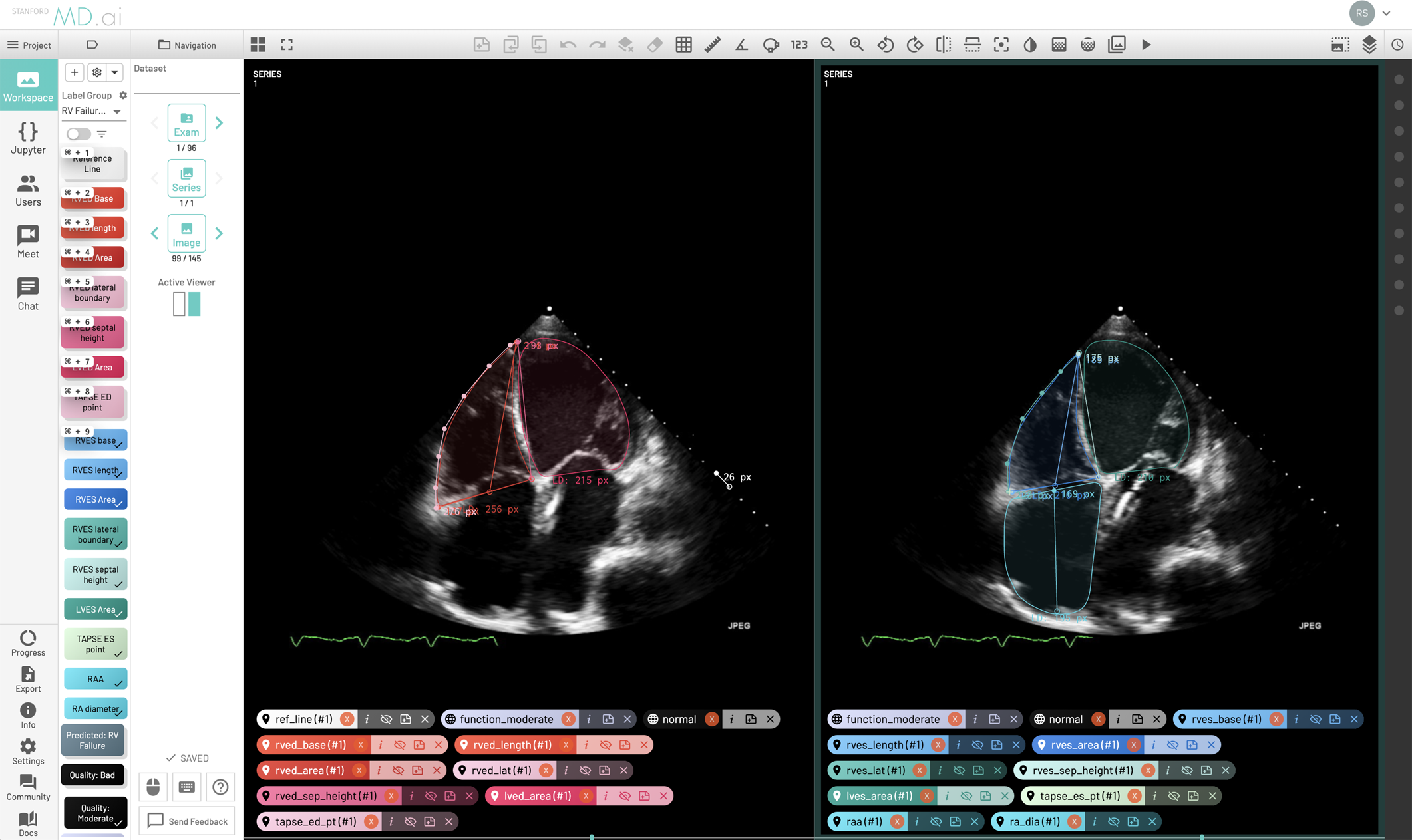 Medical Imaging Platform with AI