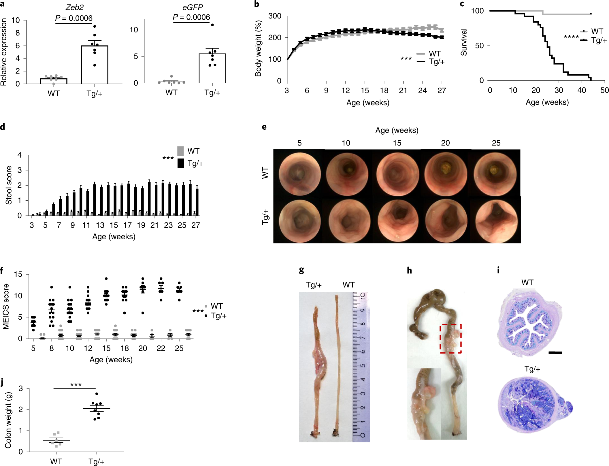 Zeb2 drives invasive and microbiota-dependent colon carcinoma | Nature  Cancer