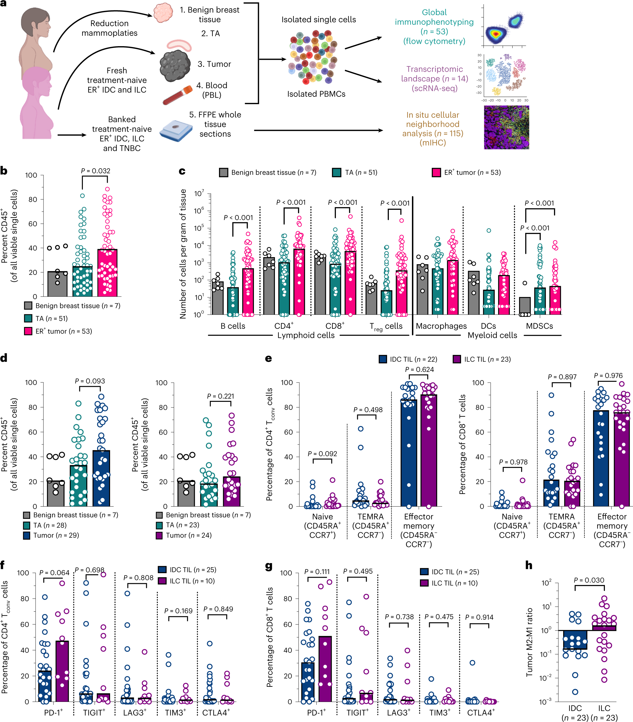Immune landscape in invasive ductal and lobular breast cancer reveals a  divergent macrophage-driven microenvironment | Nature Cancer