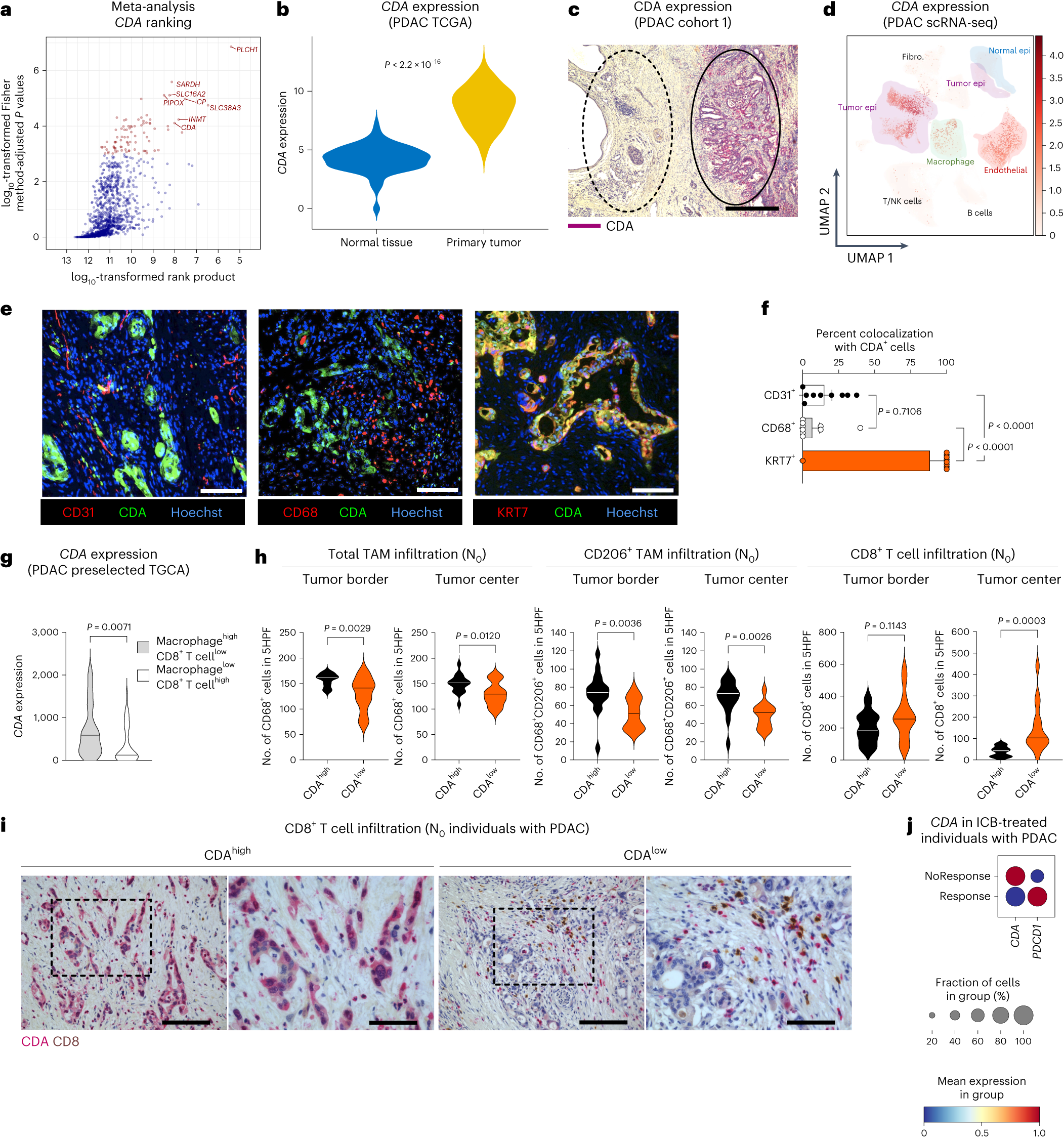 Nucleotide metabolism in cancer cells fuels a UDP-driven macrophage  cross-talk, promoting immunosuppression and immunotherapy resistance |  Nature Cancer