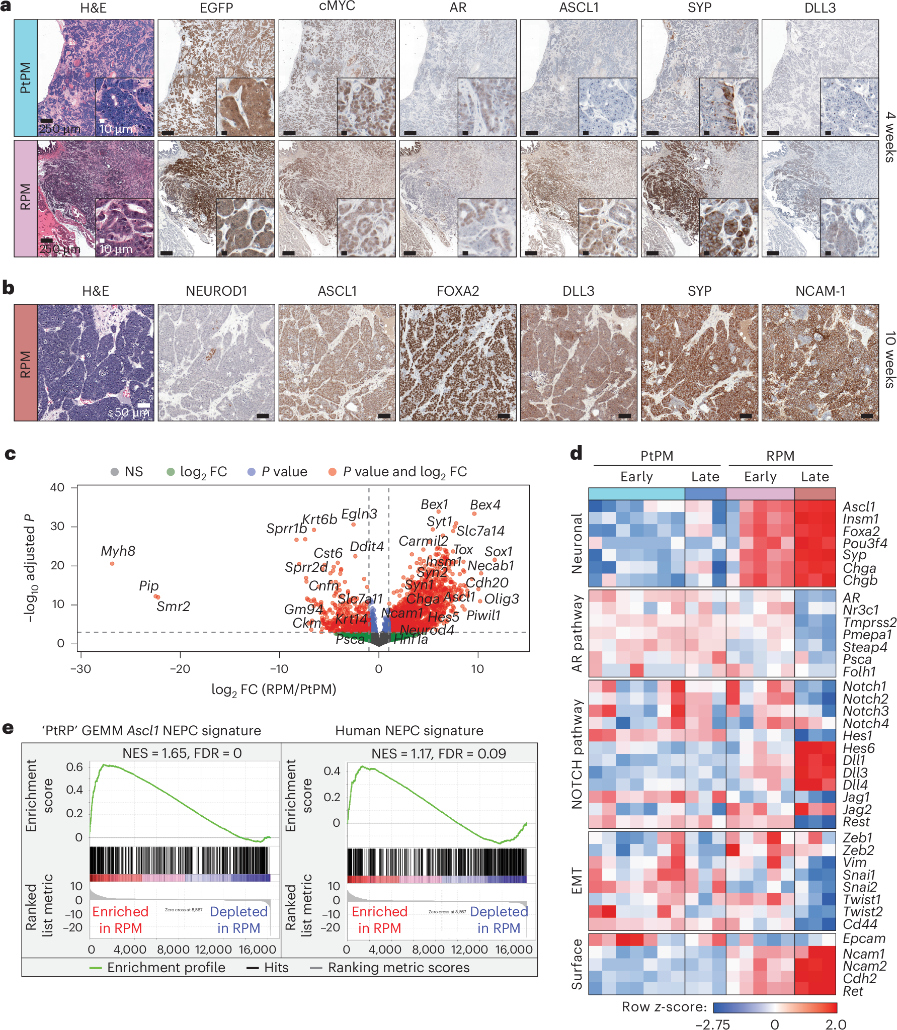 Fig. 2: Molecular characterization of PtPM and RPM primary prostate tumor transplants demonstrates emergence of neuroendocrine carcinoma marker expression.