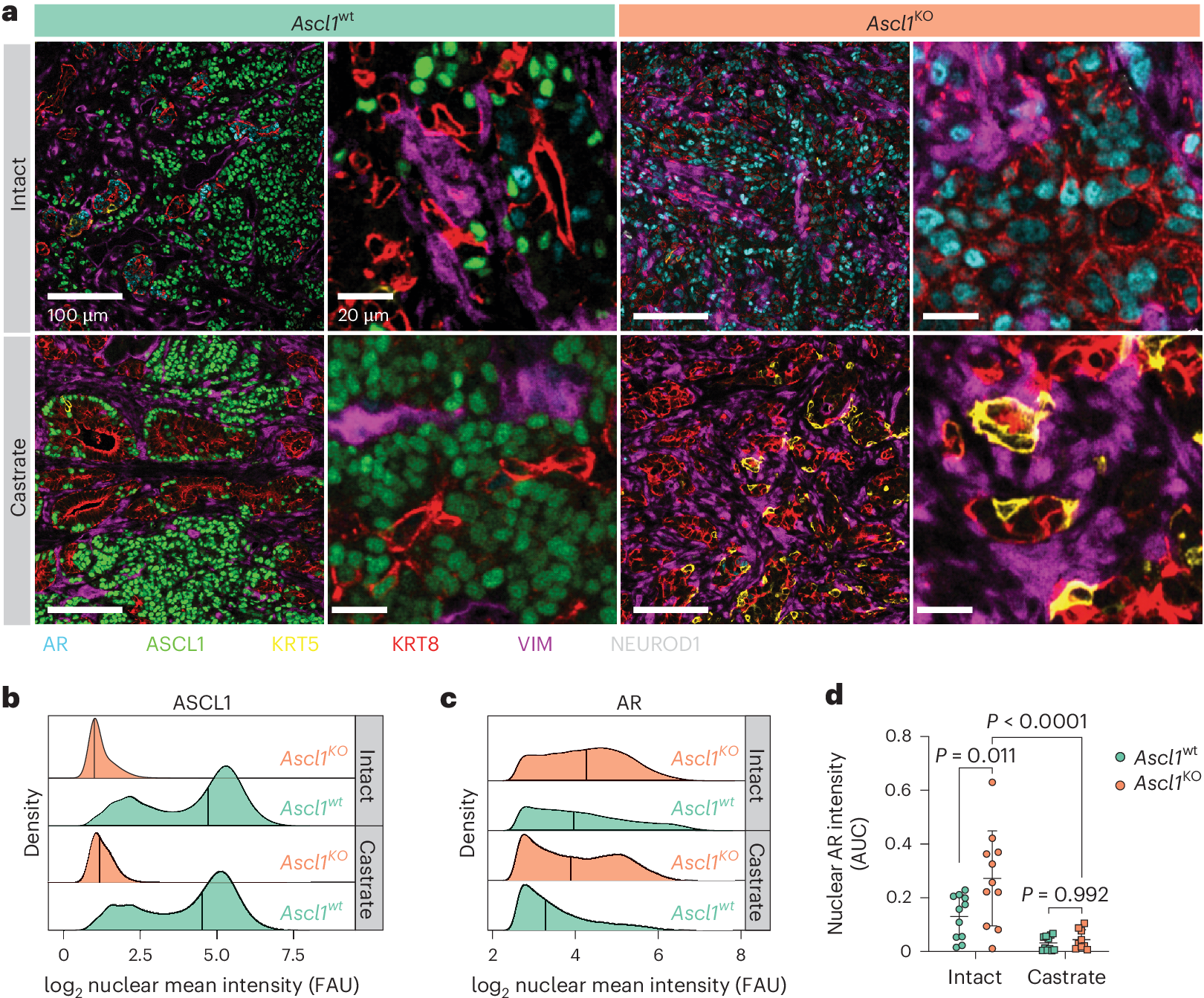 Fig. 7: Loss of Ascl1 results in enhanced AR expression and proportion of KRT8+ tumor cells.