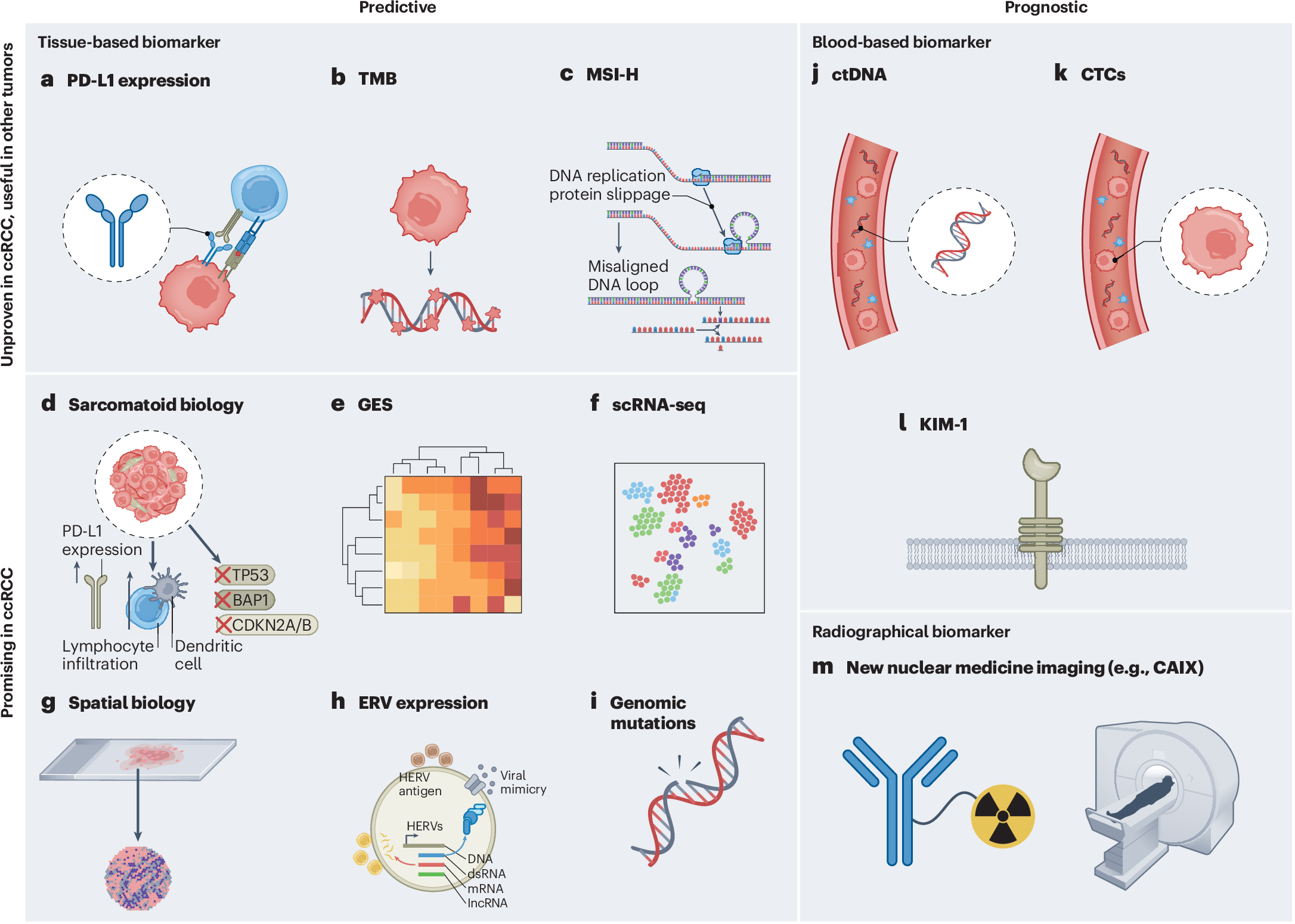 Biomarker-informed care for patients with renal cell carcinoma | Nature  Cancer
