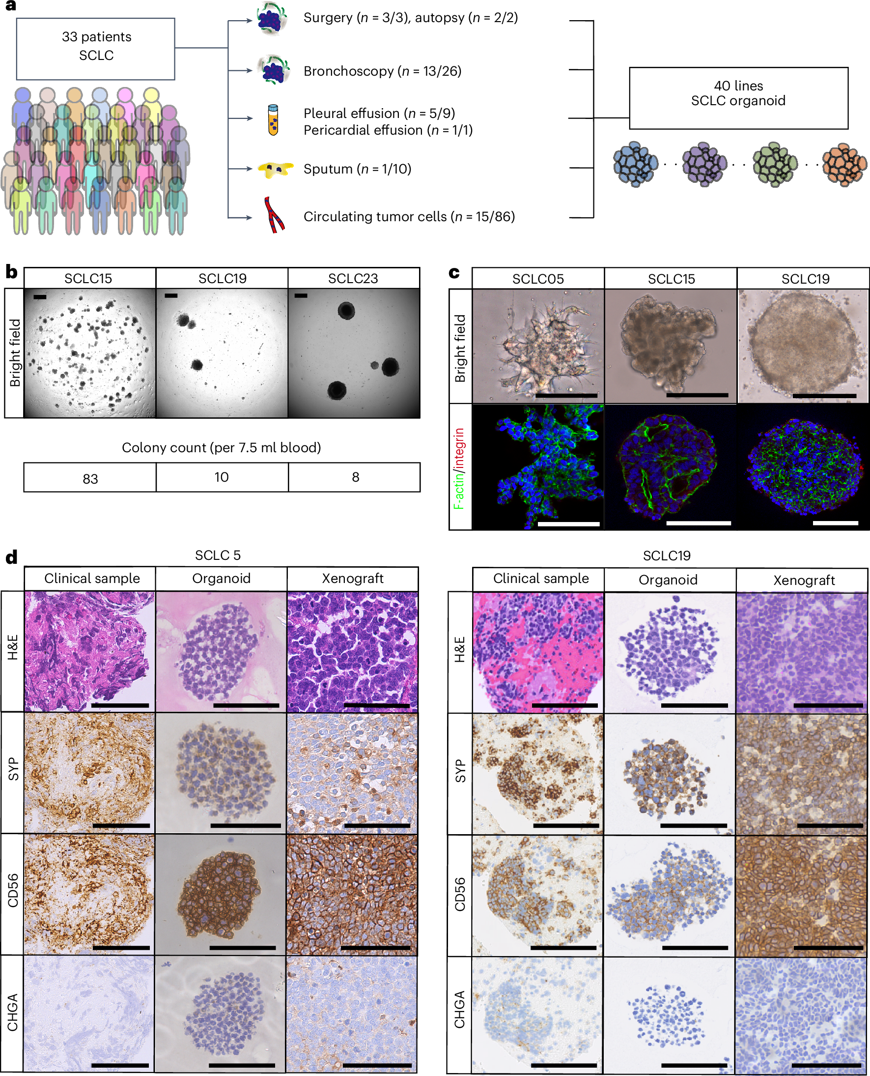 ls bd nude models An organoid library unveils subtype-specific IGF-1 dependency via a YAP–AP1  axis in human small cell lung cancer | Nature Cancer