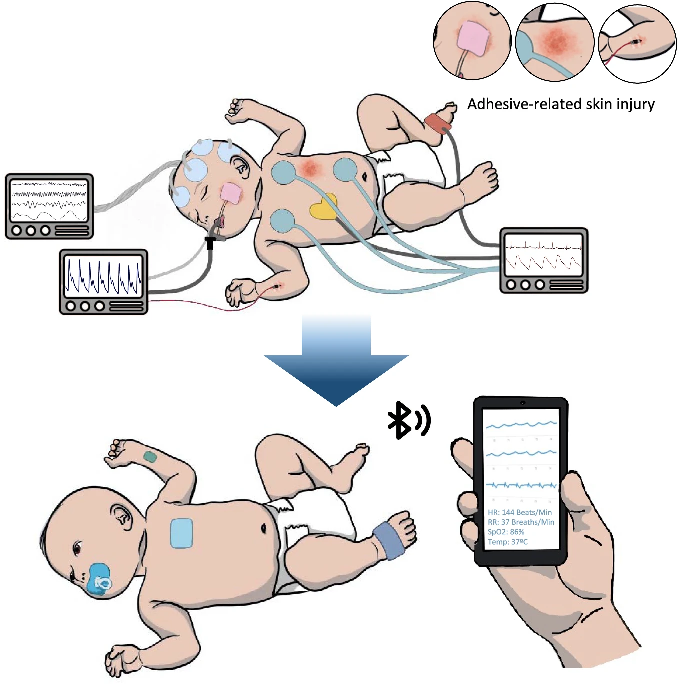 baby wearable medical devices change
