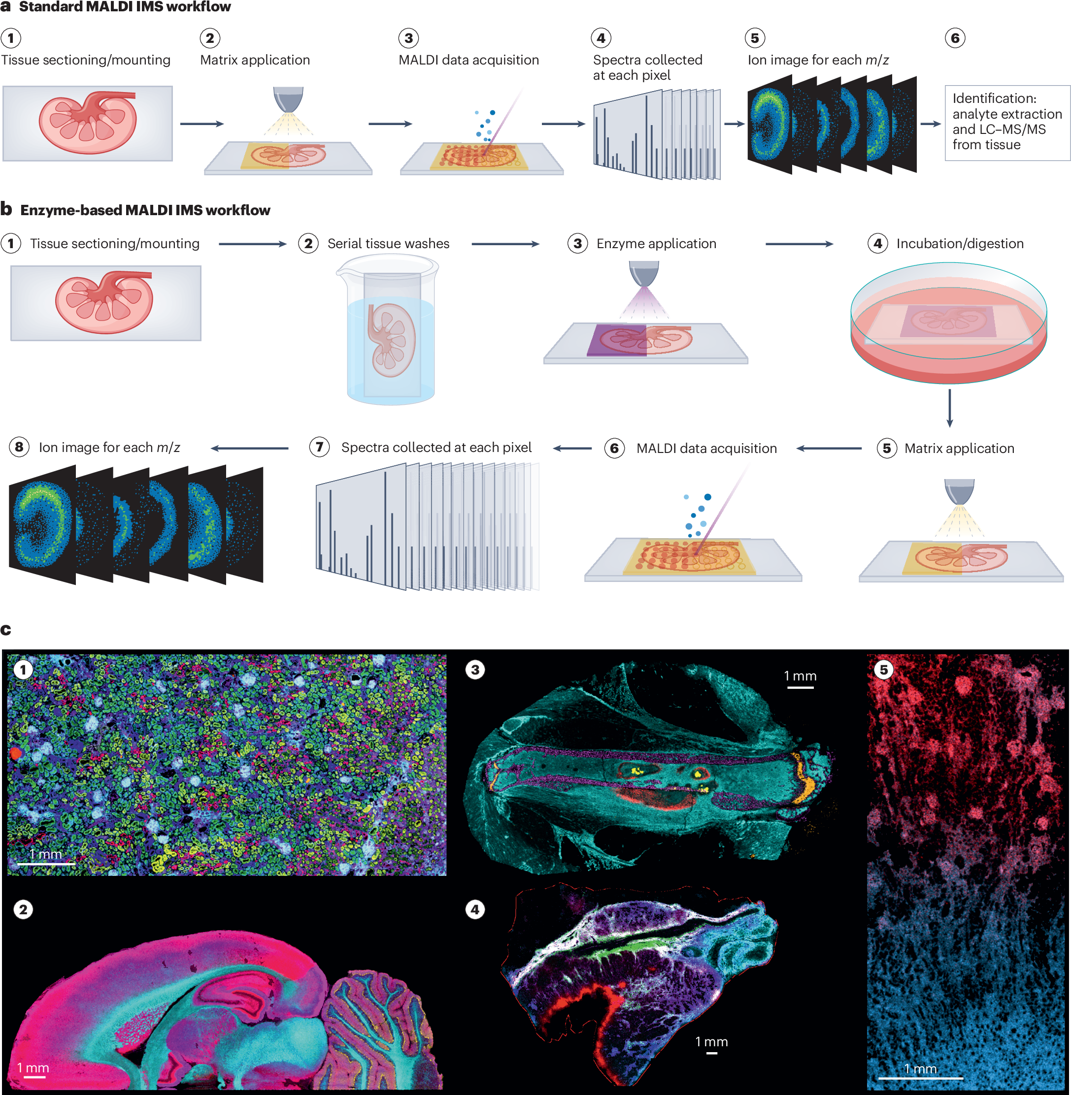 Matrix-assisted laser desorption/ionization imaging mass 