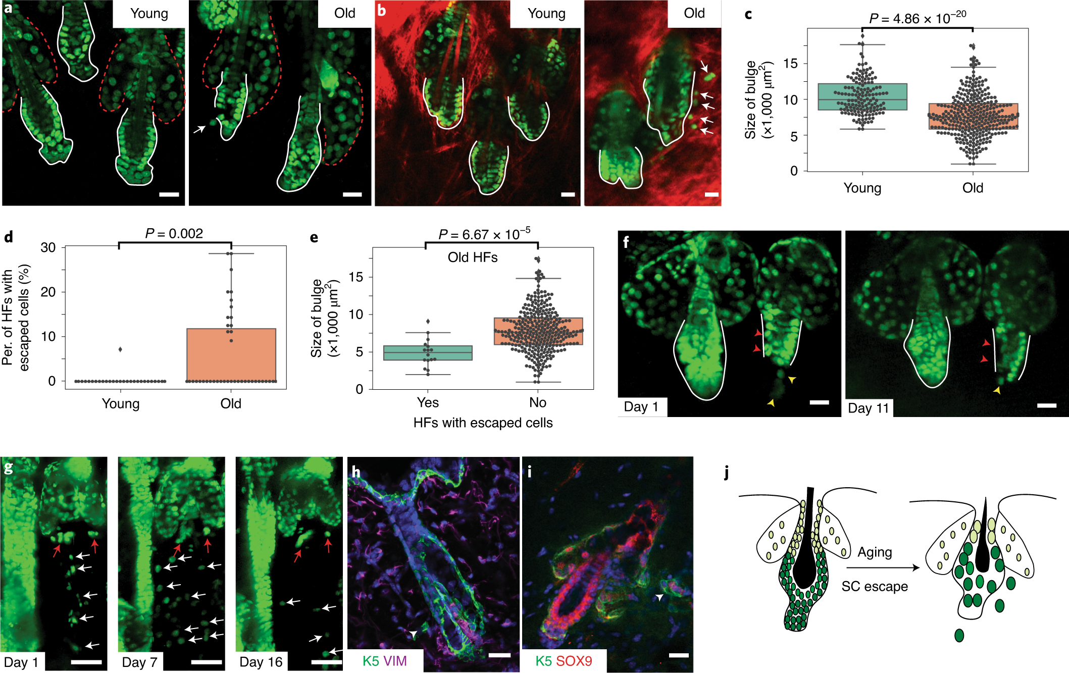 escape of hair follicle stem cells causes stem cell exhaustion during aging nature aging