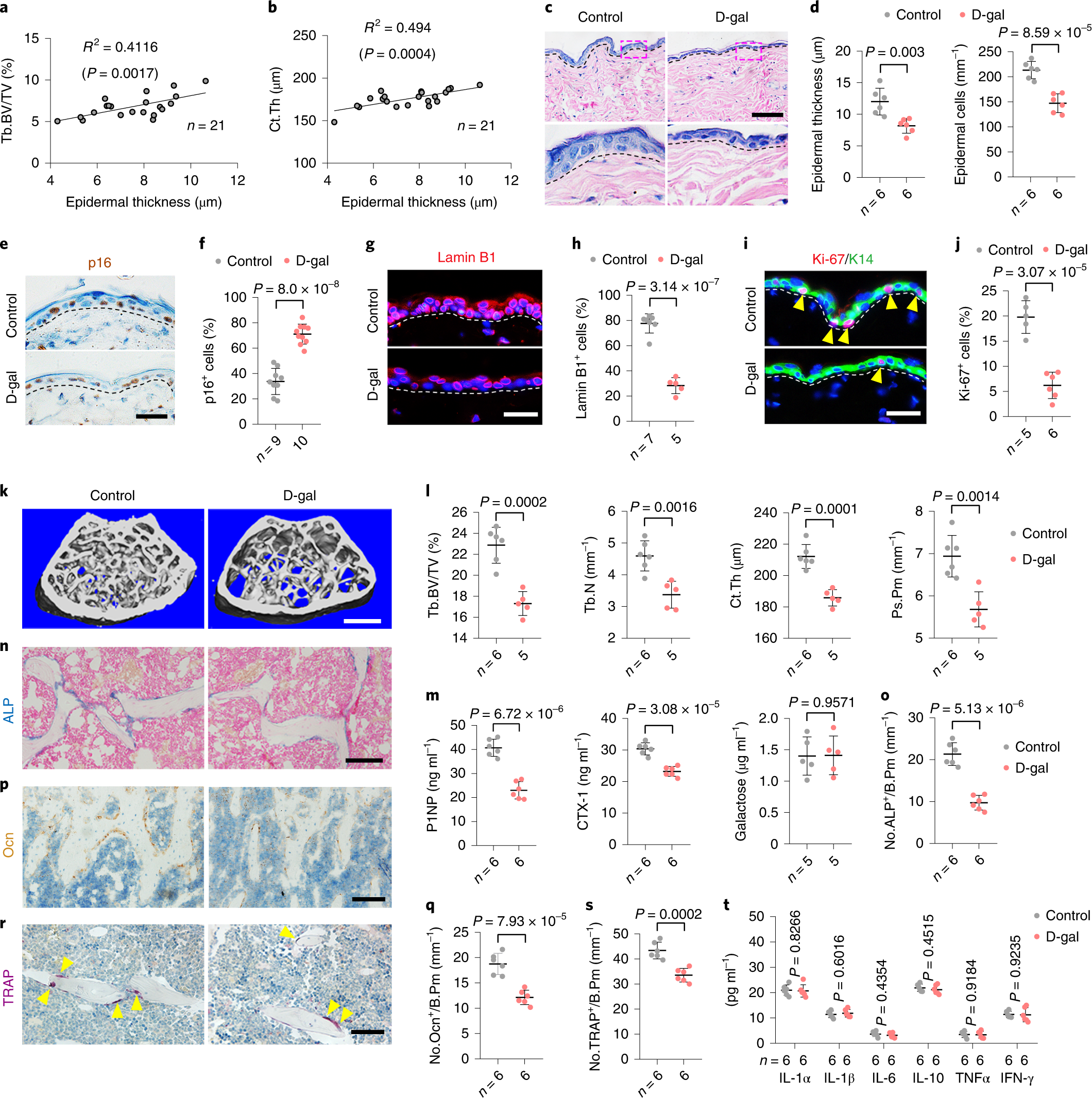 Skin chronological aging drives age-related bone loss via secretion of  cystatin-A | Nature Aging