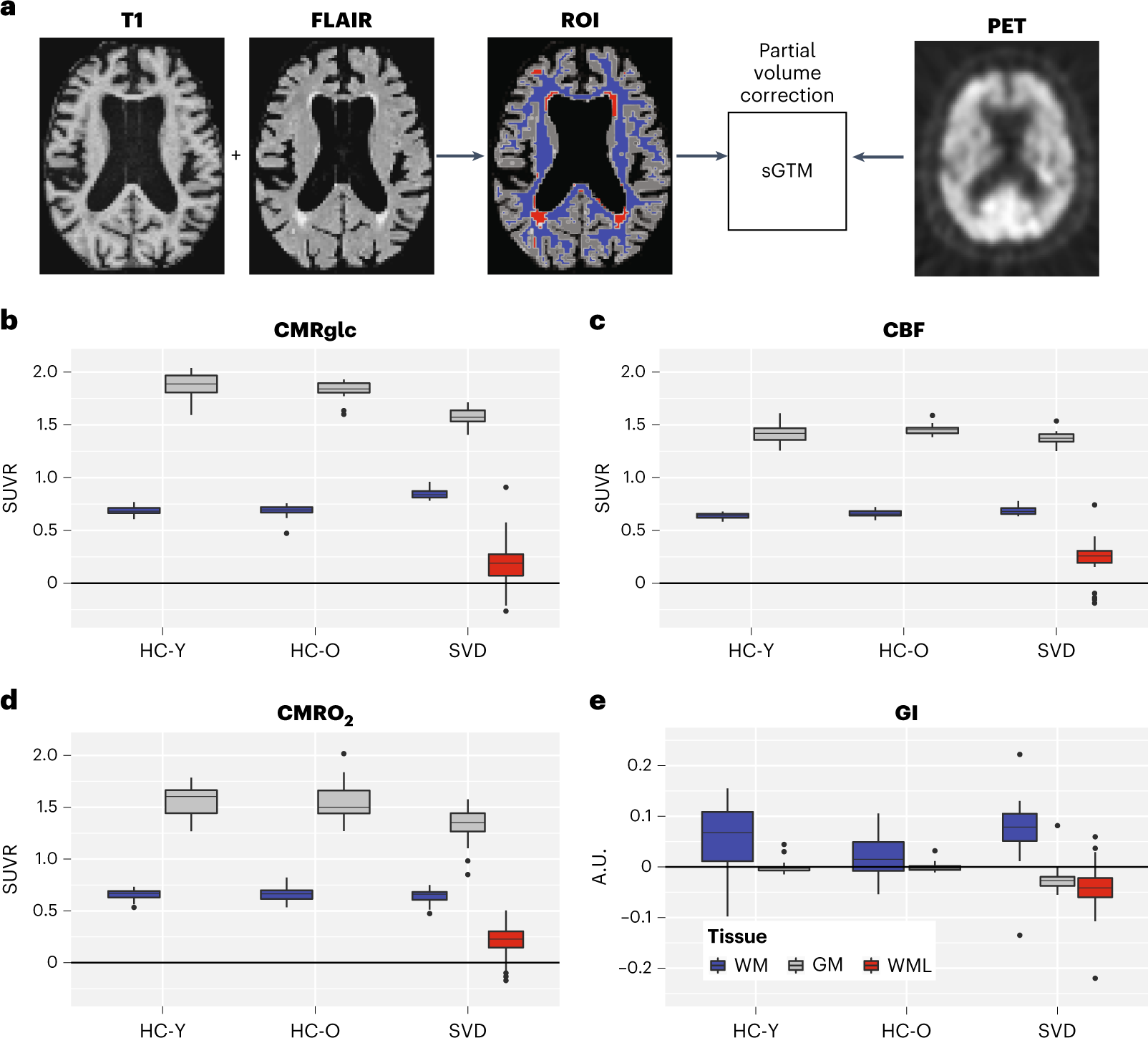 Increased white matter glycolysis in humans with cerebral small vessel  disease | Nature Aging