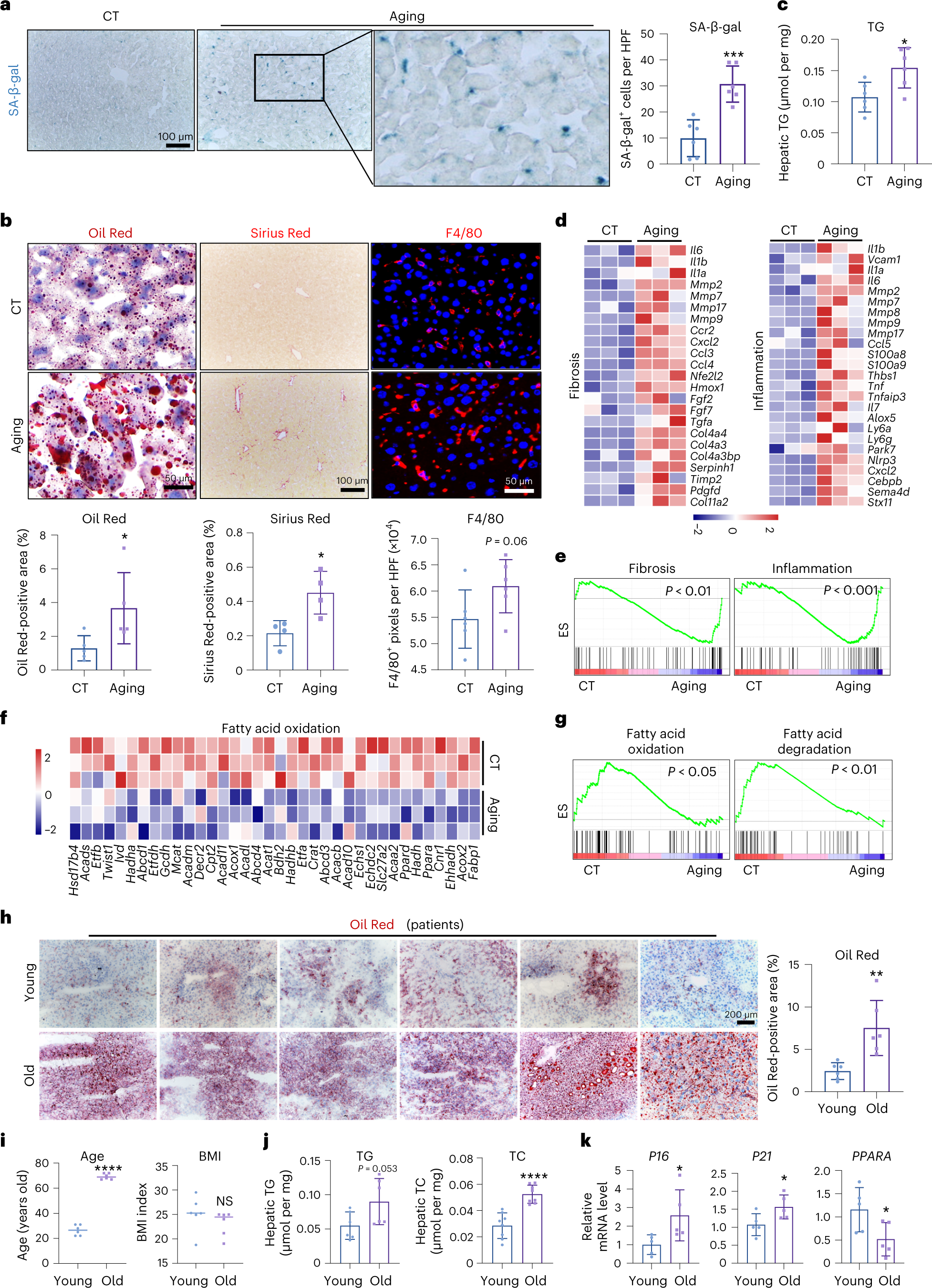 Age-related liver endothelial zonation triggers steatohepatitis by inactivating pericentral endothelium-derived C-kit Nature Aging
