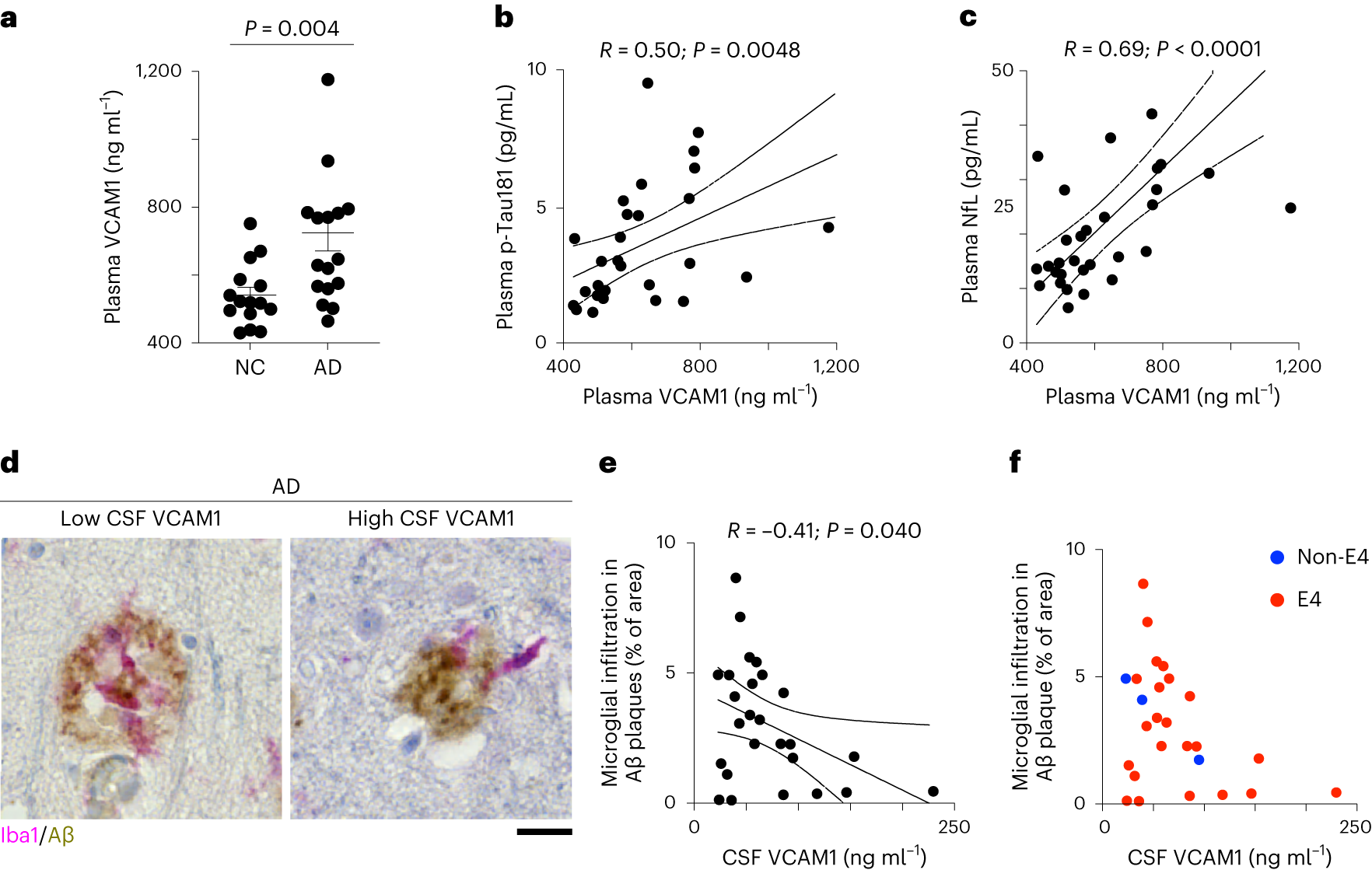 Fig. 6: Dysregulated VCAM1 signaling is associated with impaired microglial infiltration into Aβ plaques in patients with AD.