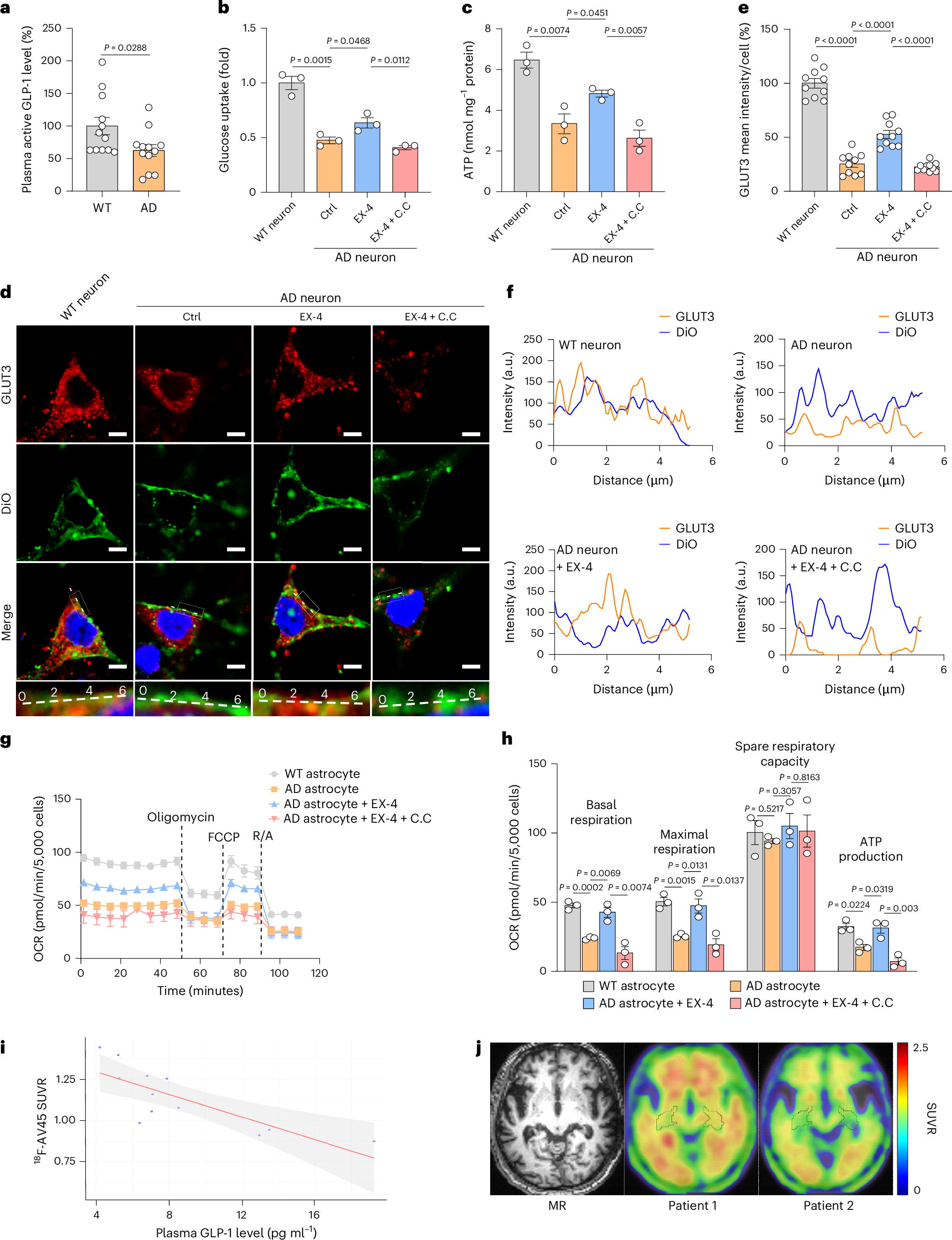 glp-1 gastric stasis lawyer in kentucky Activation of AMPK by GLP-1R agonists mitigates Alzheimer-related  phenotypes in transgenic mice