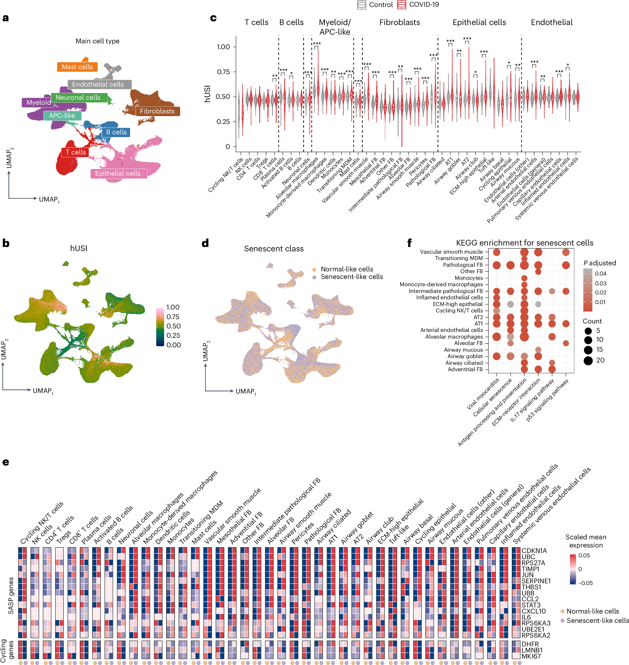 Fig. 4: hUSI enables the evaluation of senescence burden in COVID-19.