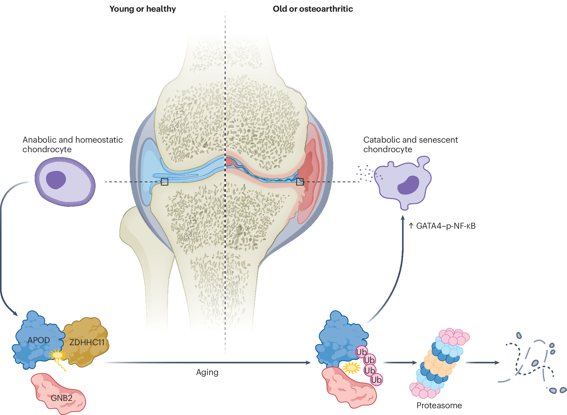 glutathione and osteoarthritis Fat modifications protect joints from degrading