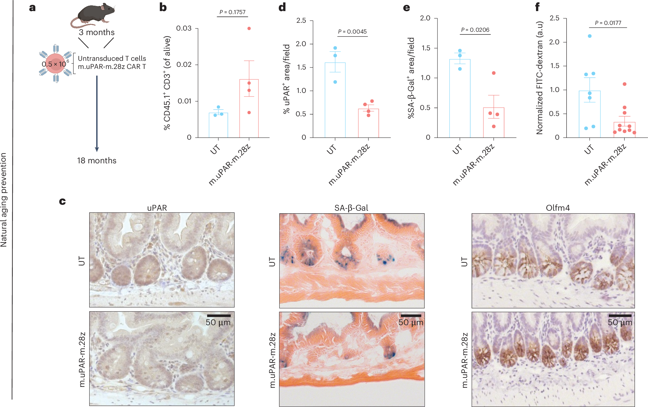 Fig. 3: Prophylactic treatment with uPAR targeting CAR T cells rescue age-related defects in intestinal epithelium integrity.