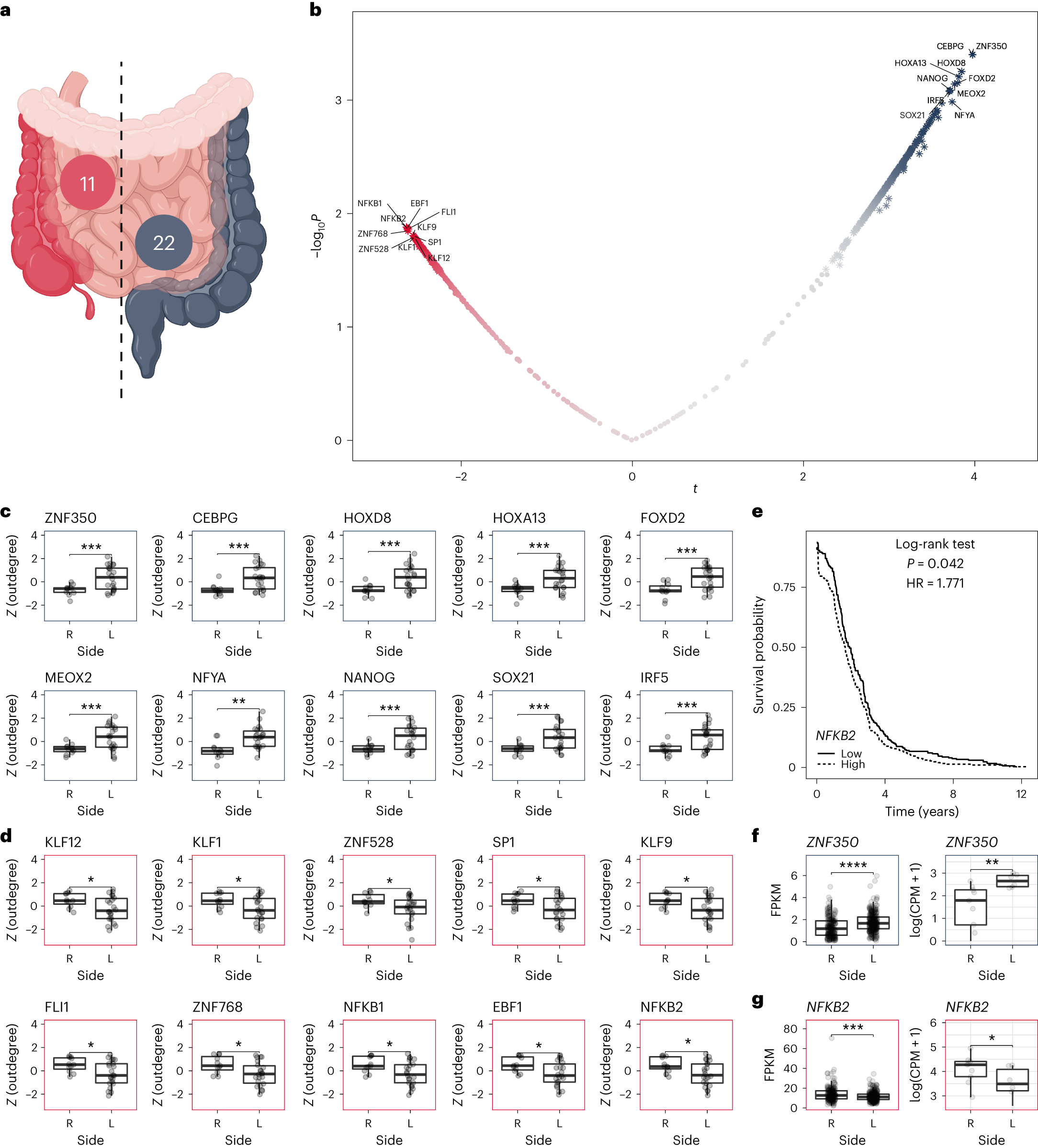 Fig. 6: Regulatory differences between right-sided and left-sided colorectal cancer epithelial cells.