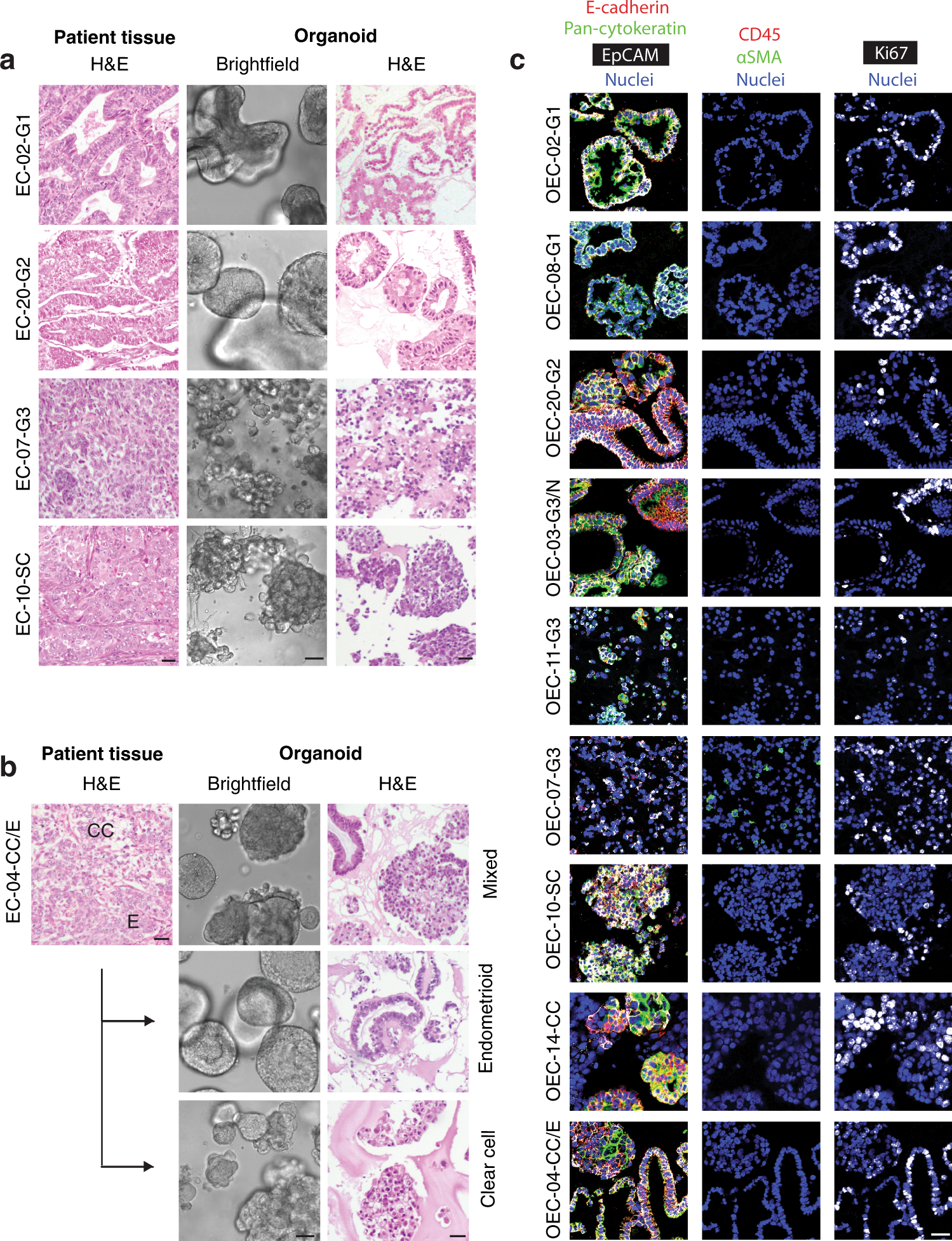 Patient-derived organoids reflect the genetic profile of endometrial tumors  and predict patient prognosis | Communications Medicine