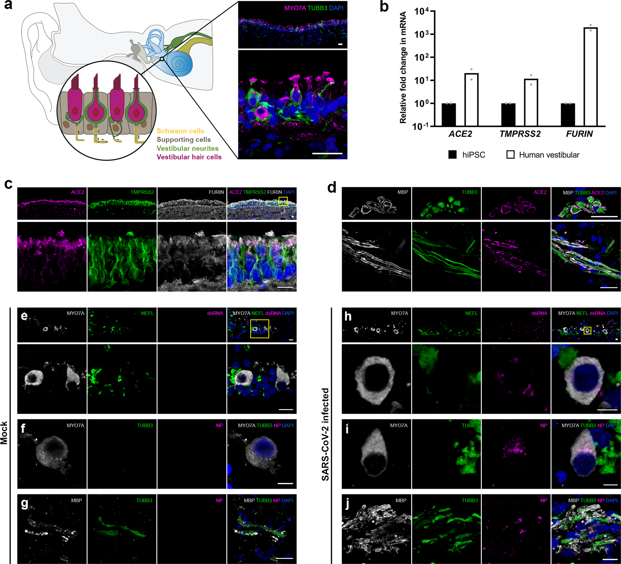 Fig. 2: Expression of SARS-CoV-2 cell entry-related receptor and entry-associated proteases in human peripheral vestibular tissue.
