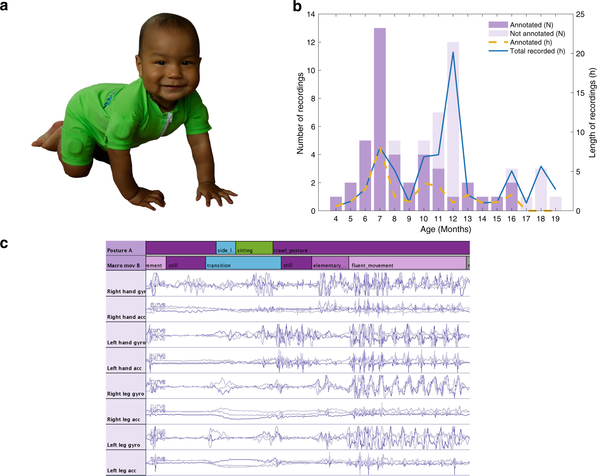 Intelligent wearable allows out-of-the-lab tracking of developing motor  abilities in infants | Communications Medicine