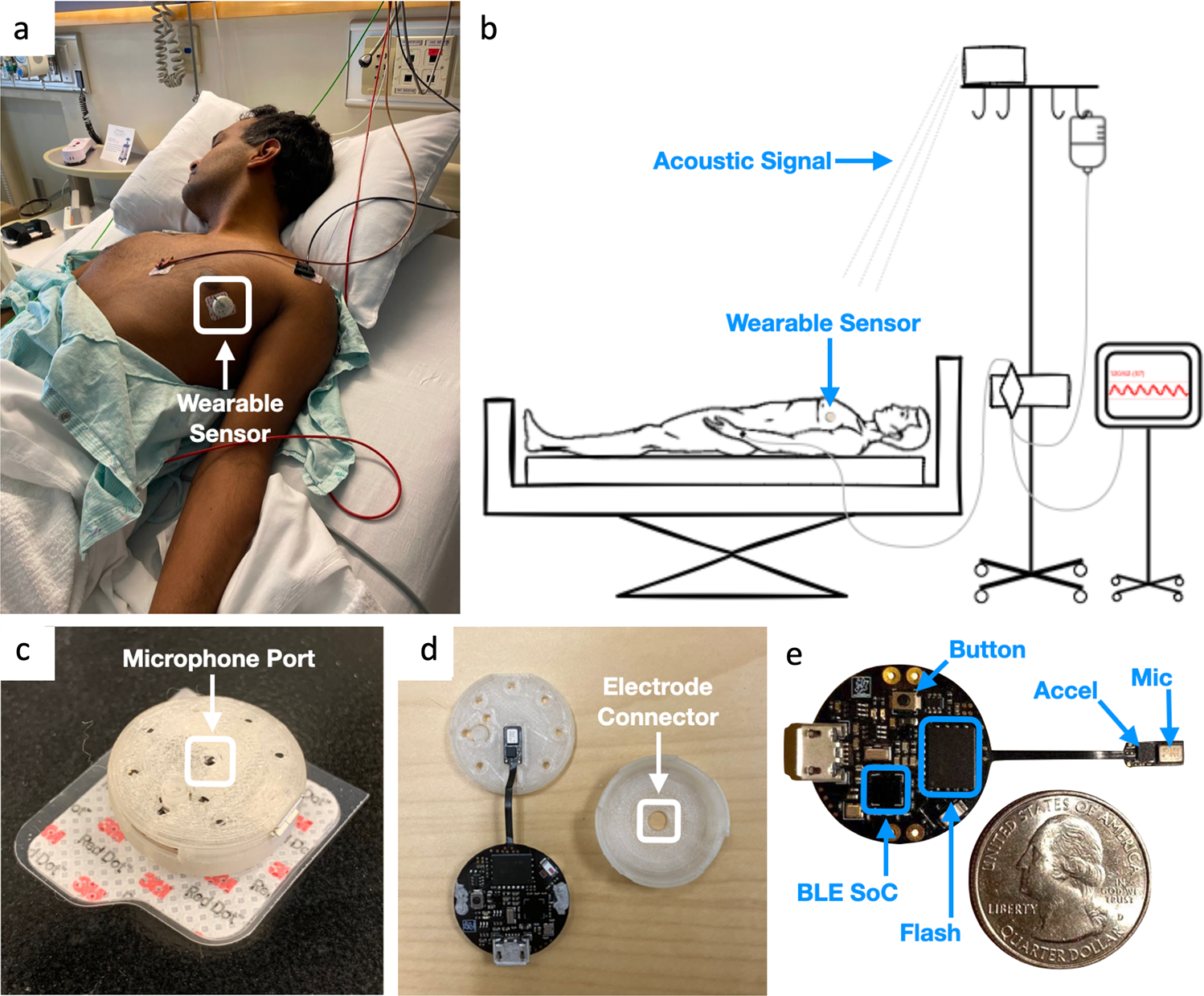 A Low-power wearable acoustic device for accurate invasive arterial  pressure monitoring | Communications Medicine