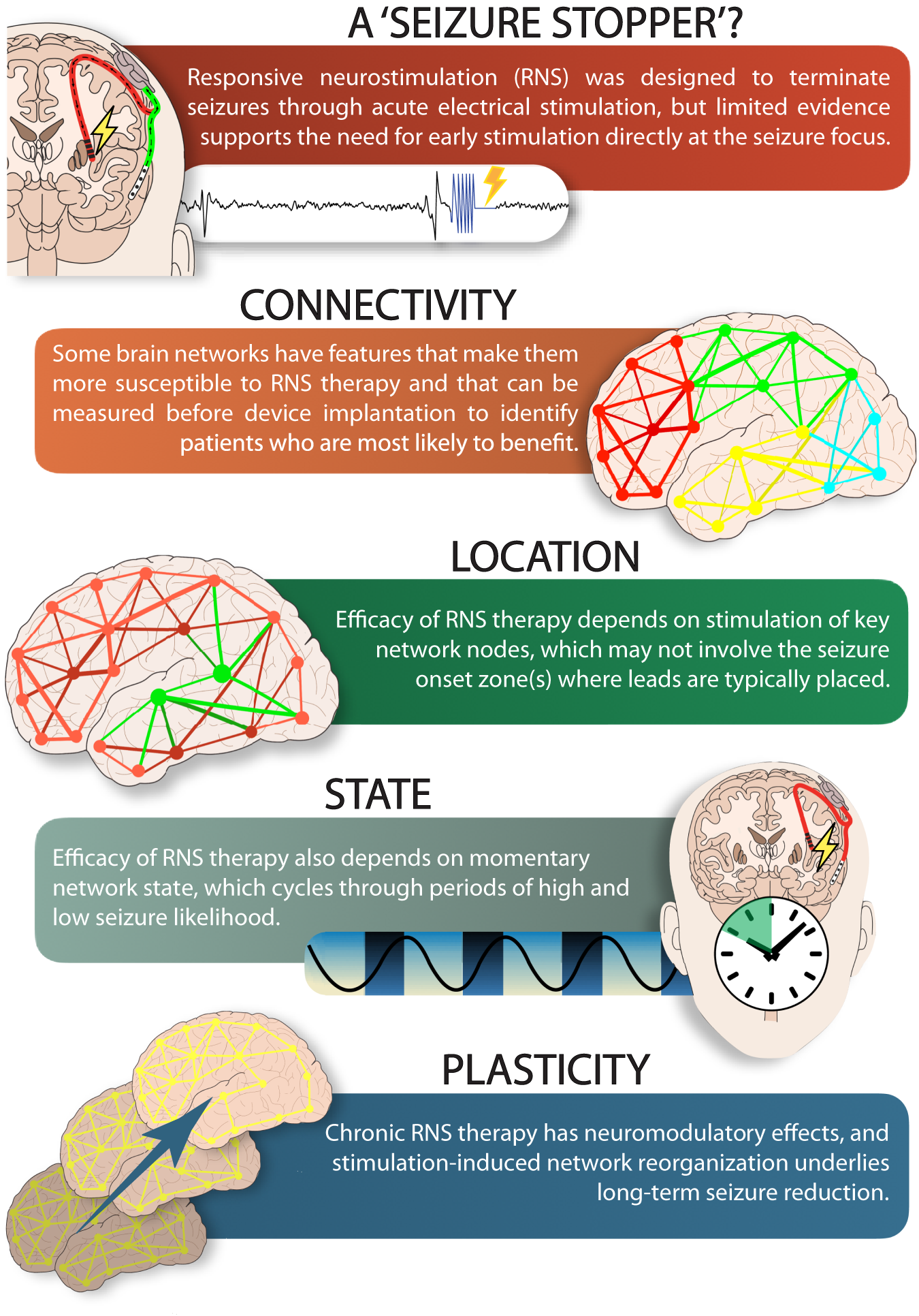 Unearthing the mechanisms of responsive neurostimulation for epilepsy |  Communications Medicine