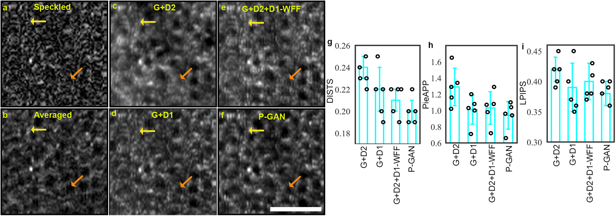 Fig. 2: Effect of parallel discriminator generative adversarial network (P-GAN) components on the recovery of retinal pigment epithelial (RPE) cells.