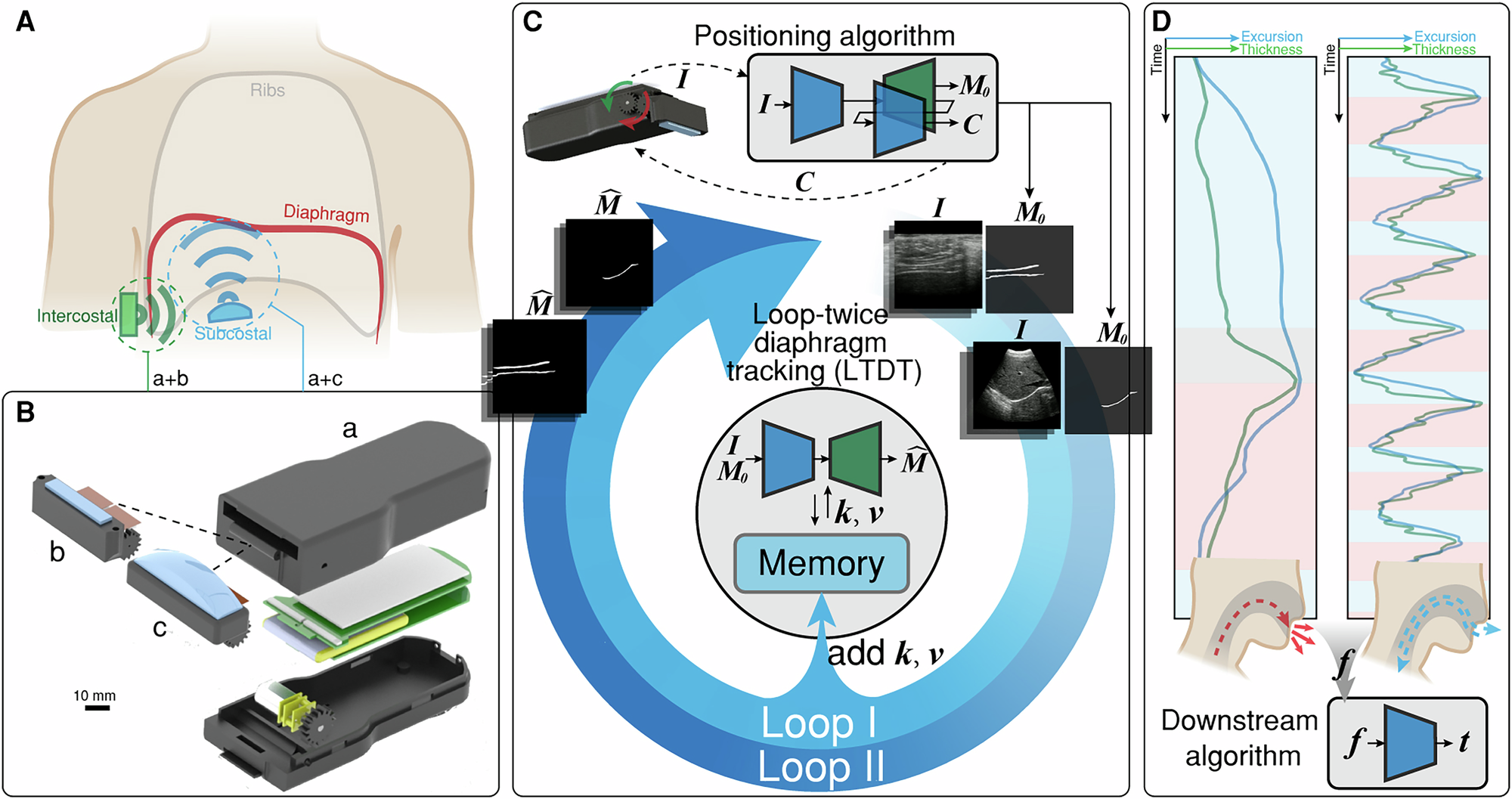 Fig. 1: Overview of the multi-view ultrasound system for diaphragm monitoring.