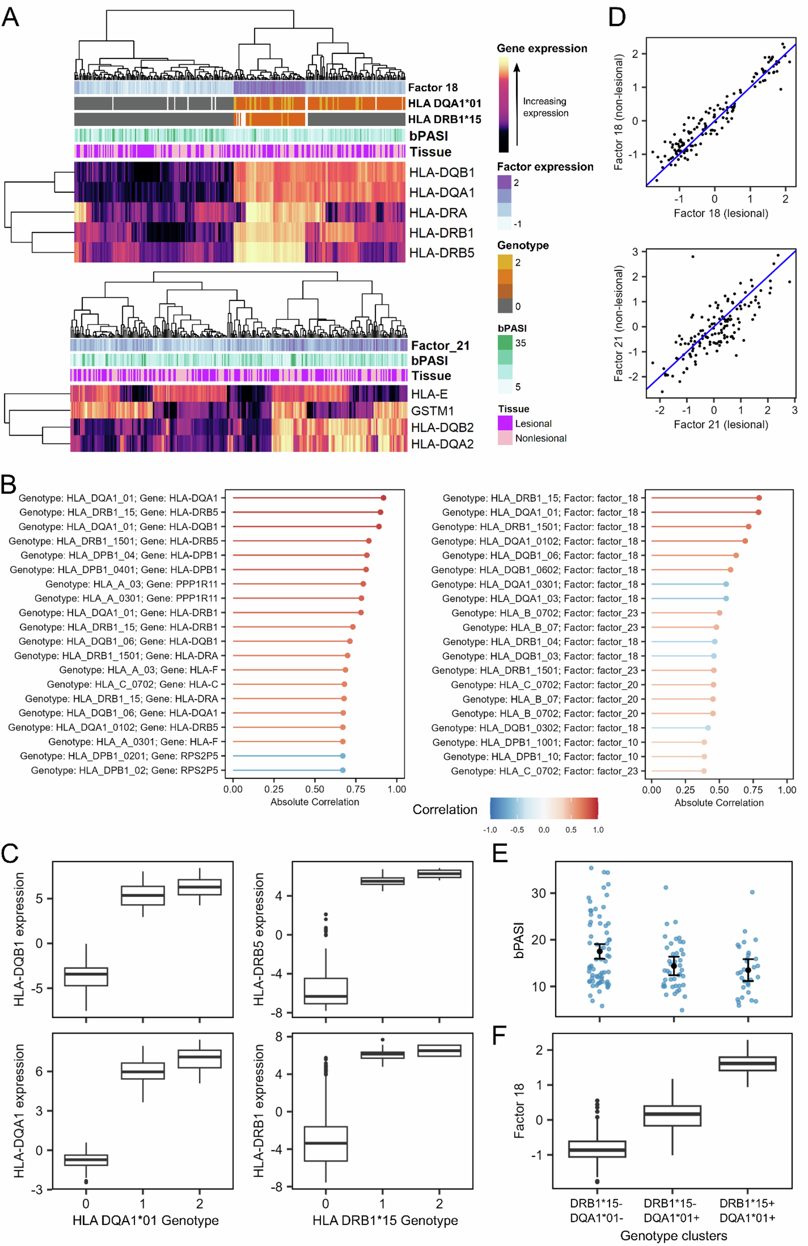 Fig. 5: Latent factor S18 defines HLA-driven patient clusters associated with baseline disease severity.