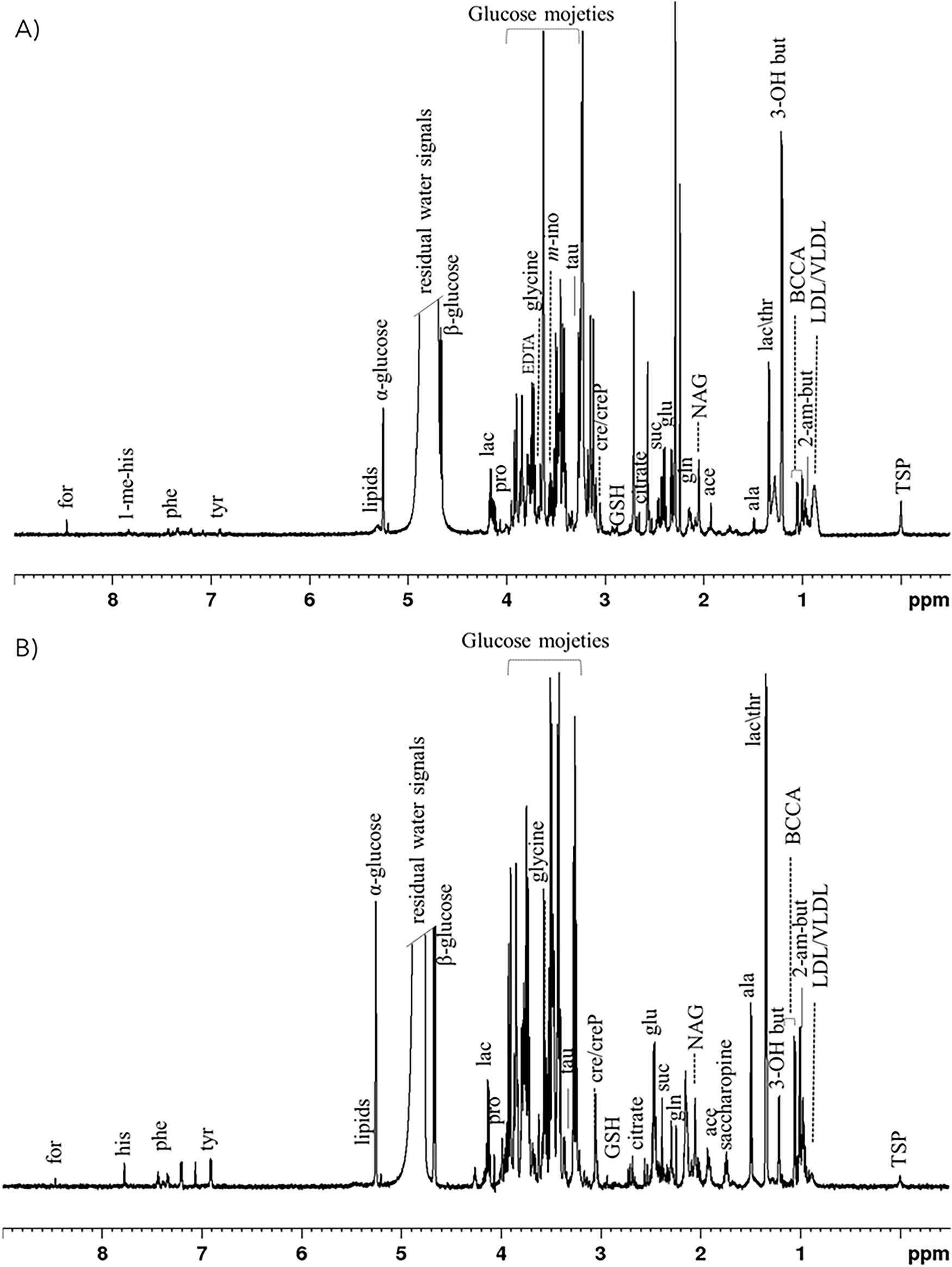 Fig. 1: Representative 1H CPMG NMR spectra of plasma and pericardial fluid samples derived from patients affected of IHD.