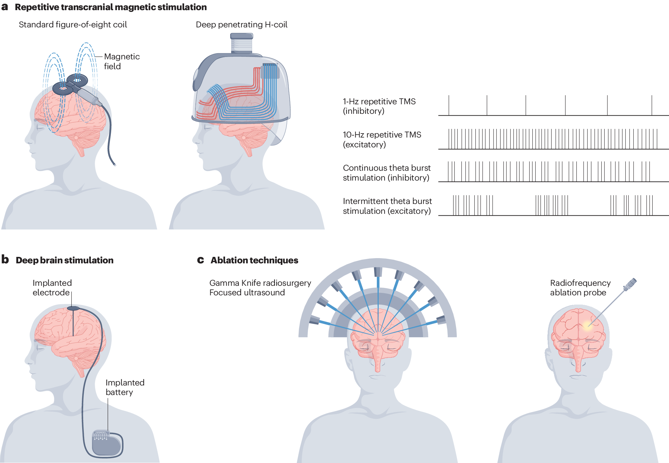 Cognitive effects of focal neuromodulation in neurological and 