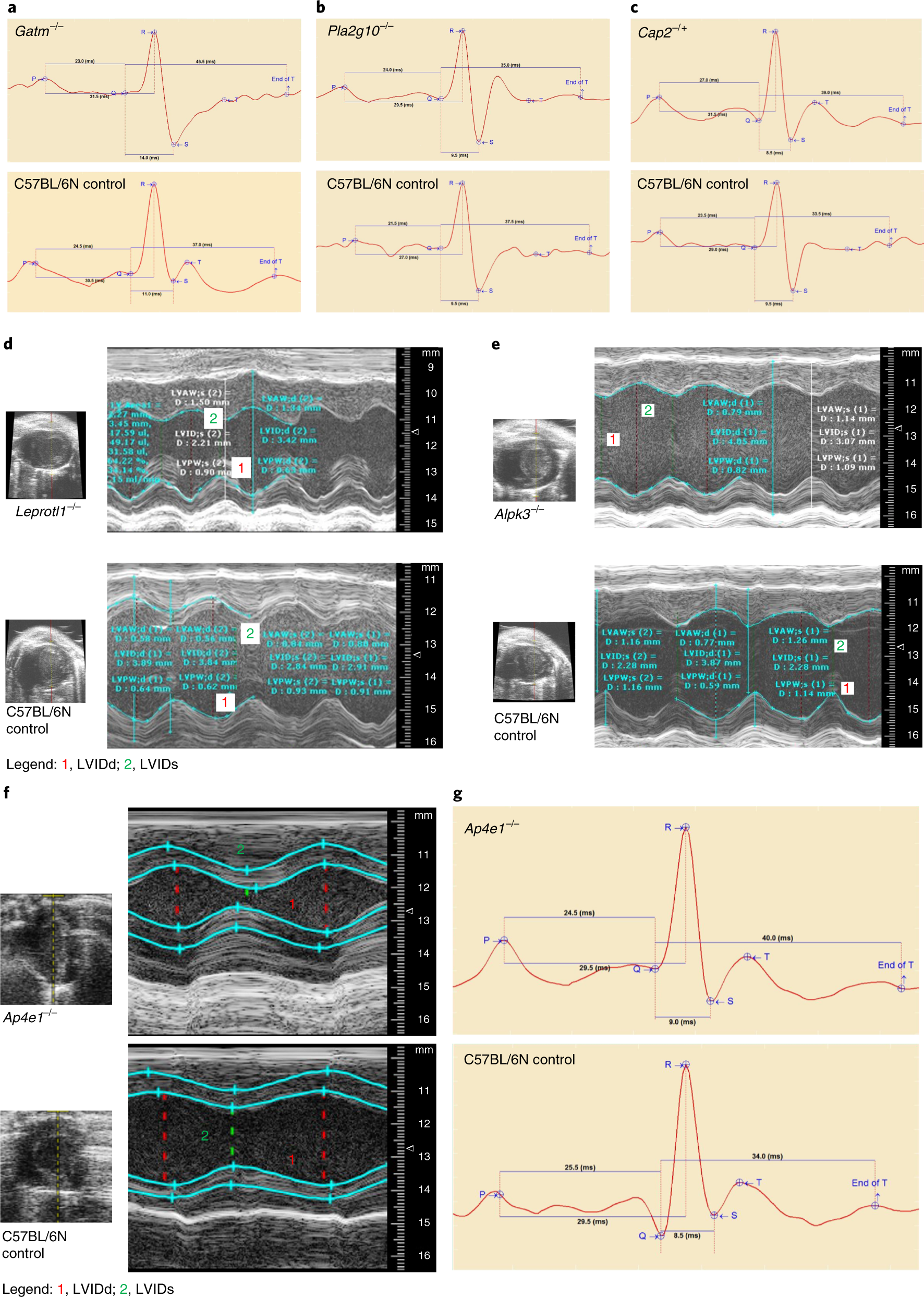 Extensive identification of genes involved in congenital and structural  heart disorders and cardiomyopathy | Nature Cardiovascular Research
