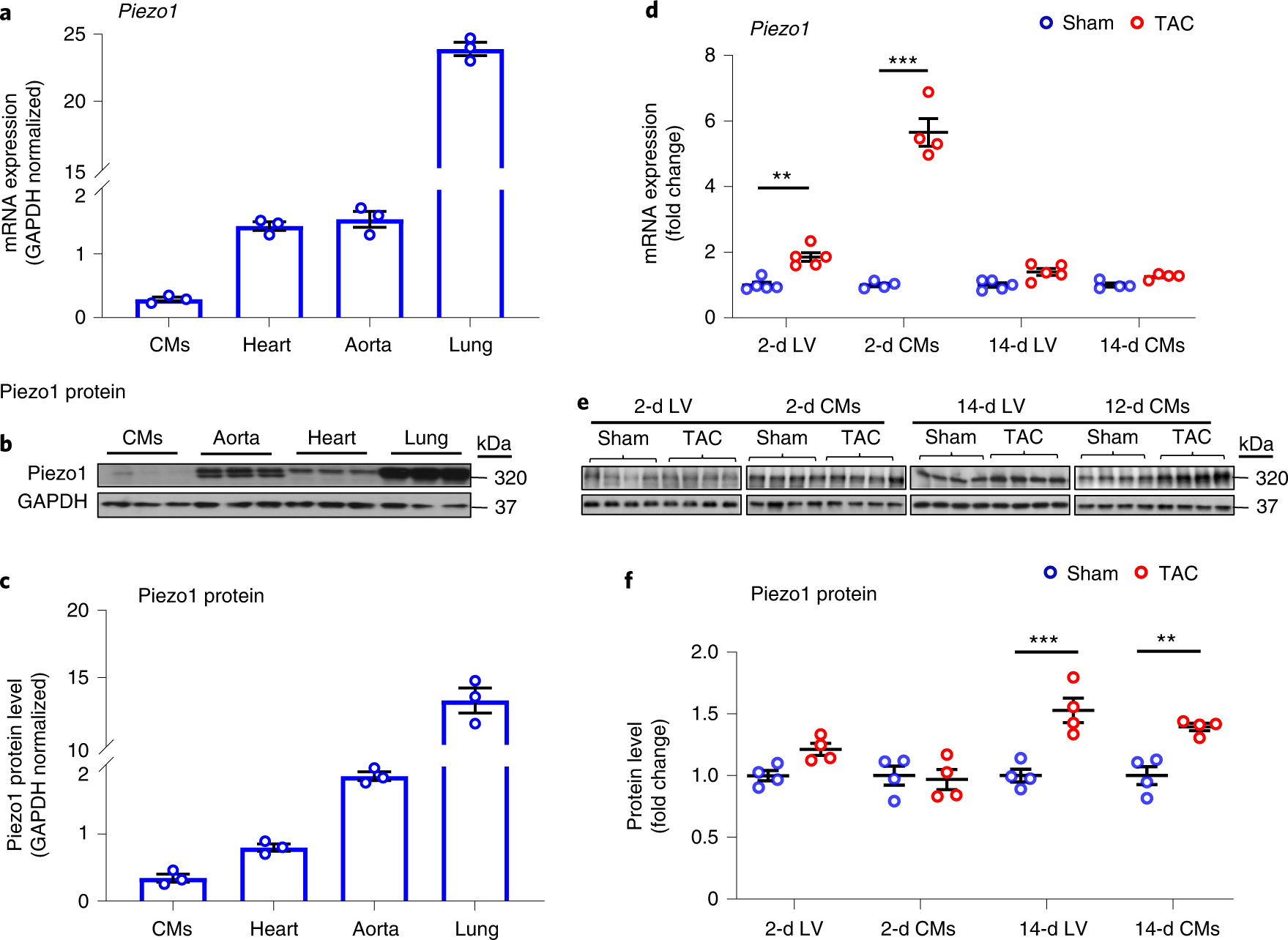 Piezo1 is the cardiac mechanosensor that initiates the cardiomyocyte  hypertrophic response to pressure overload in adult mice | Nature  Cardiovascular Research