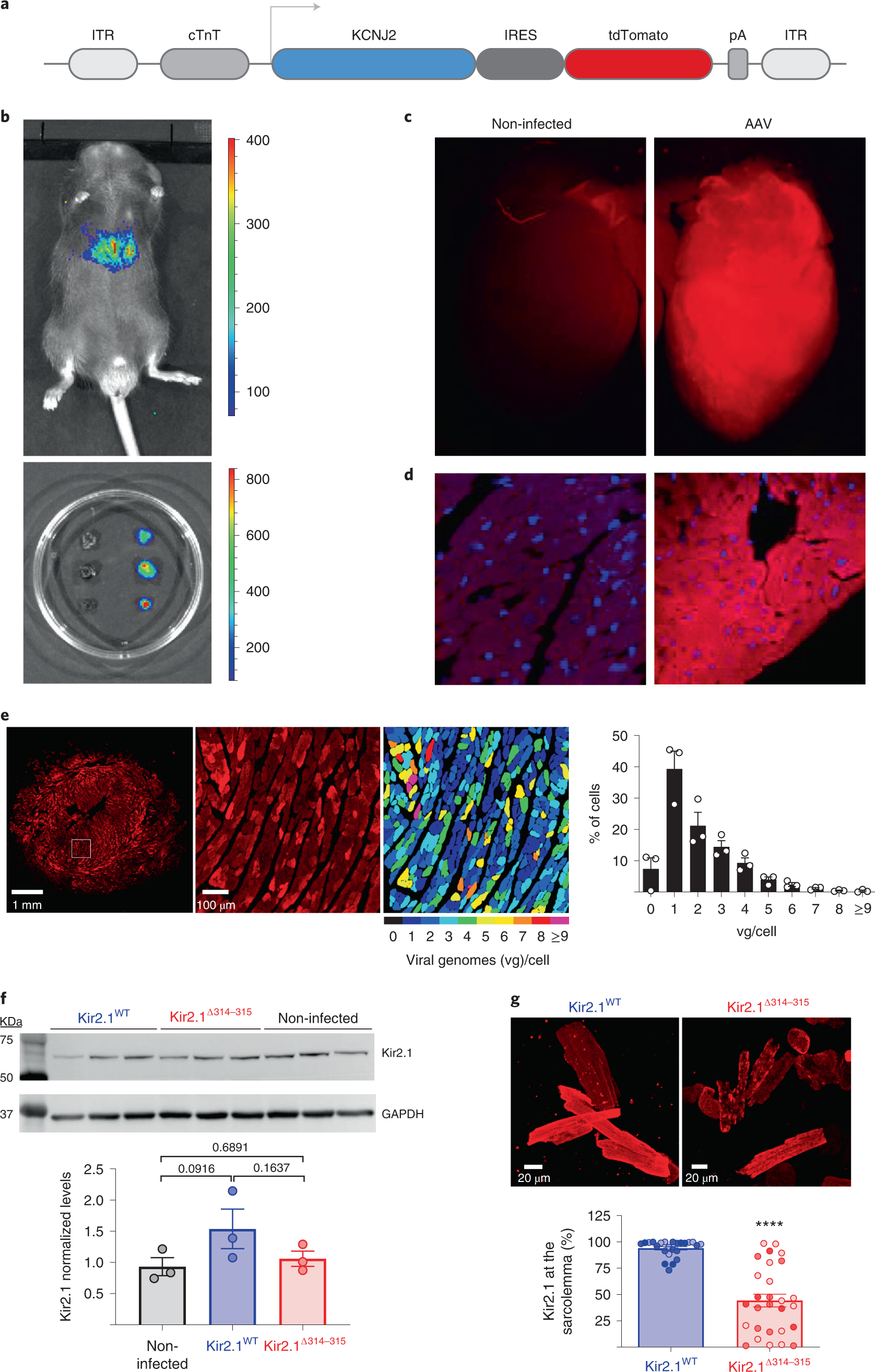 Kir2.1 dysfunction at the sarcolemma and the sarcoplasmic reticulum causes arrhythmias in a model of syndrome type 1 Nature Cardiovascular Research