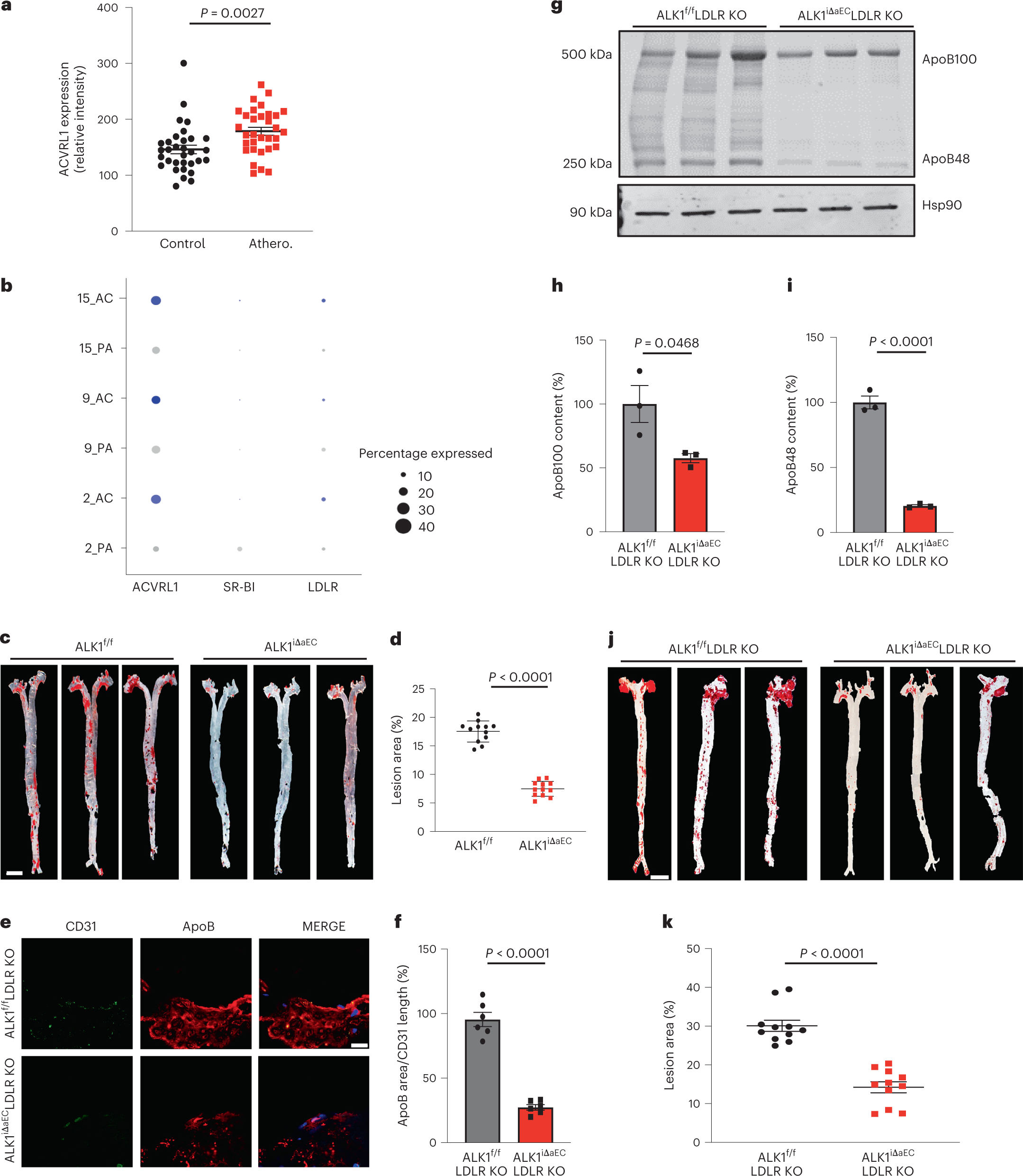 Fig. 1: ALK1 expression is increased in human atherosclerotic arteries and ALK1 deletion prevents atherosclerosis via impaired LDL uptake.