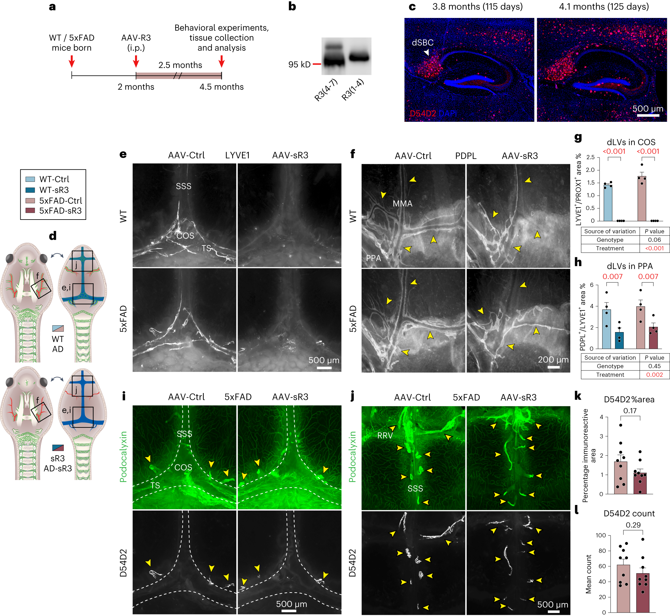 Fig. 4: Dural Aβ load in 5xFAD mice is not affected by AAV-sR3 induced dLV regression.