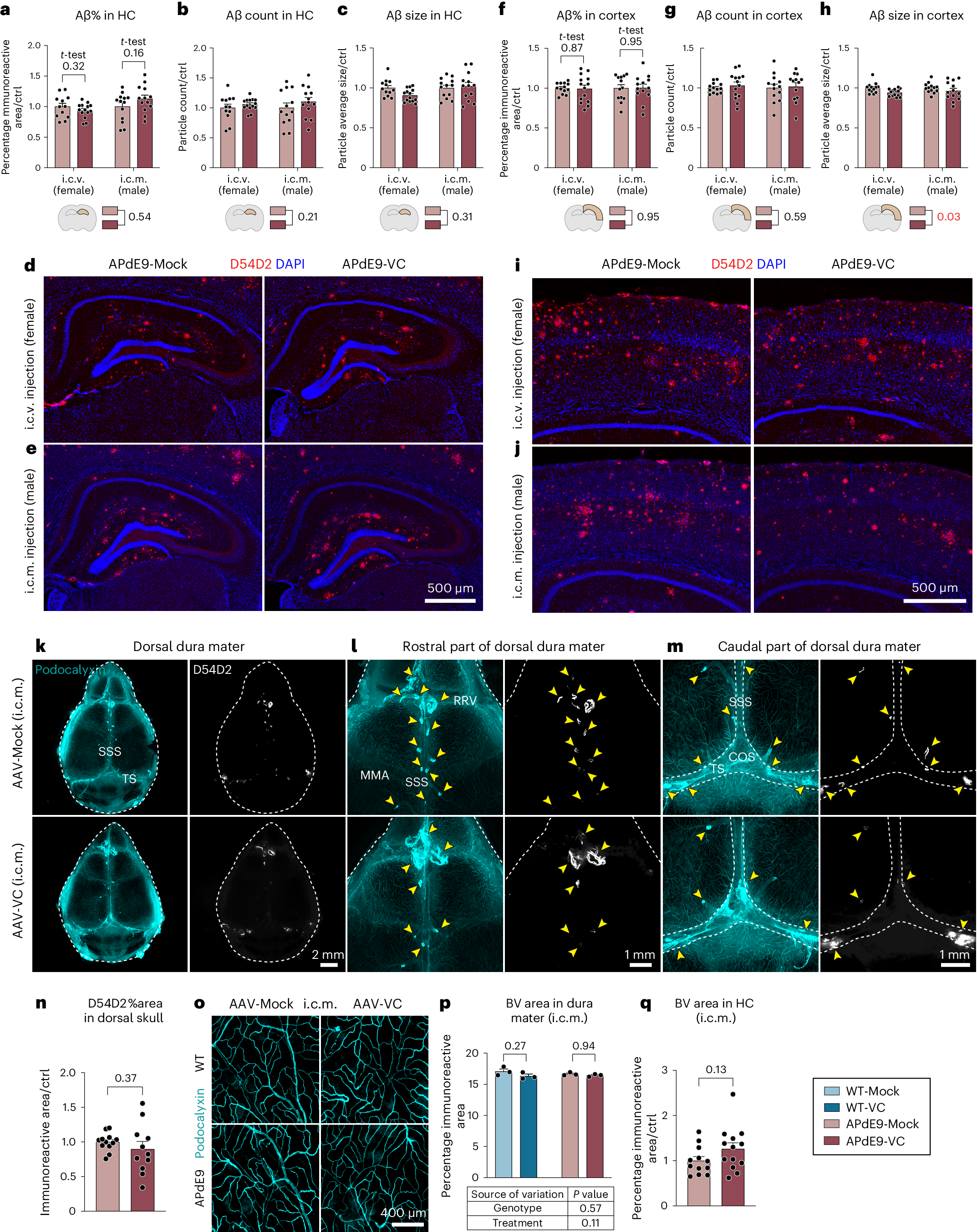 Fig. 7: AAV-VC induced dLV expansion does not affect Aβ deposits in brain or dura mater in APdE9 mice.