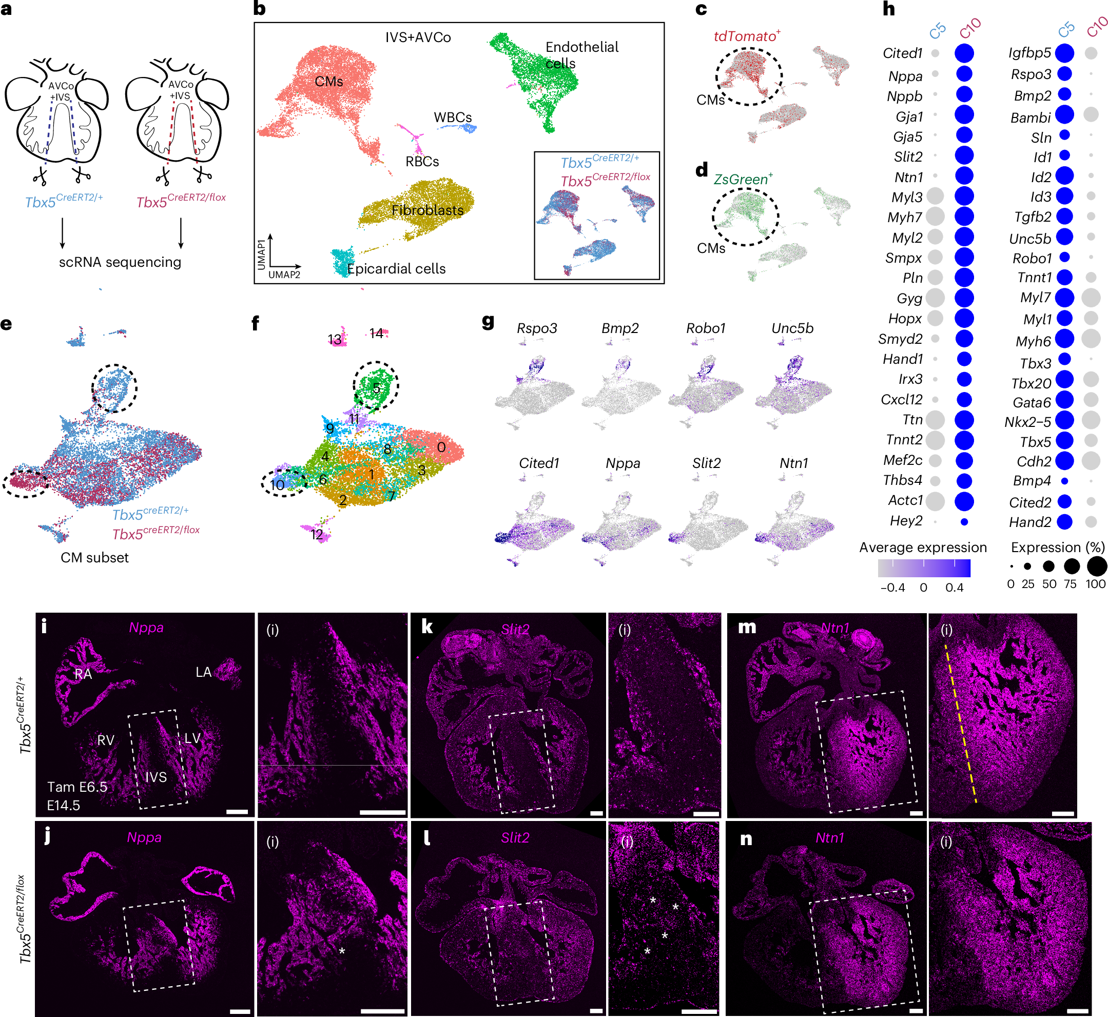 Fig. 5: Slit2 and Ntn1 are Tbx5-sensitive genes in the IVS.