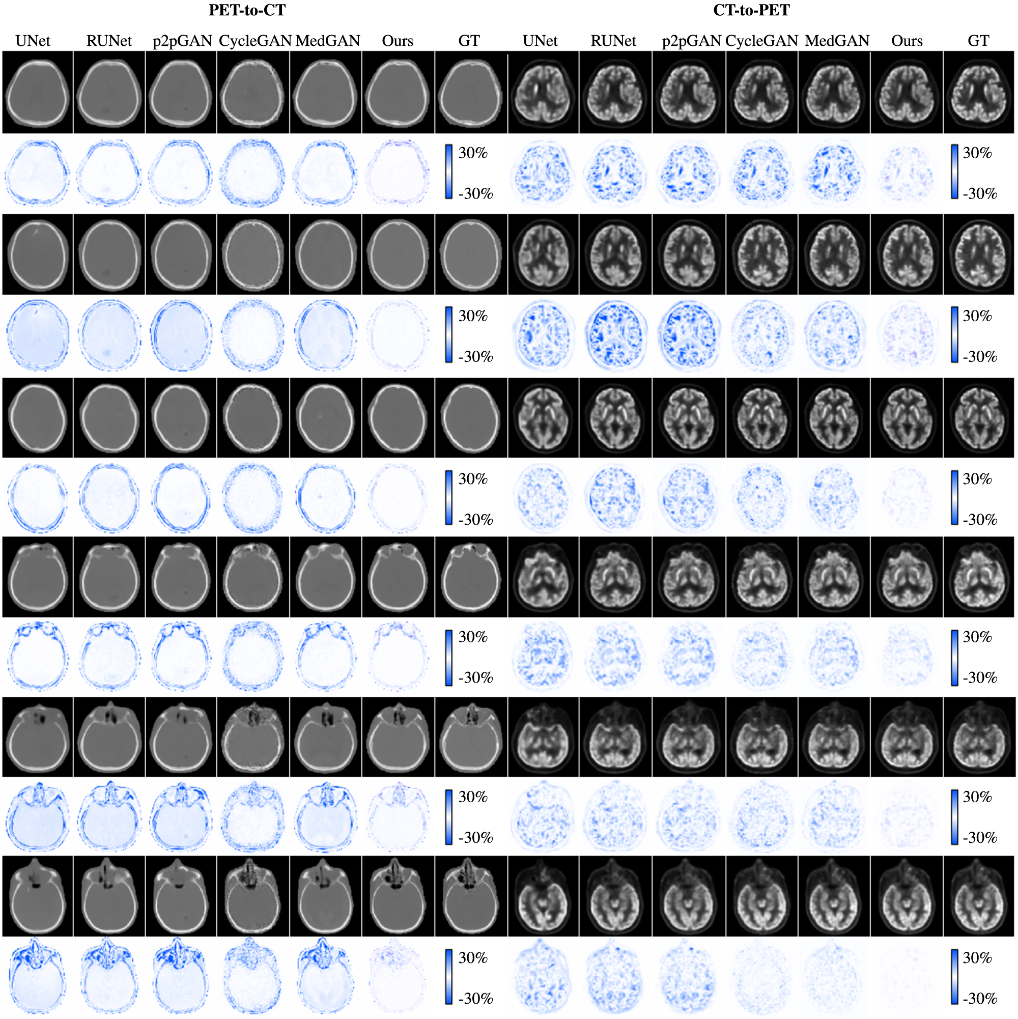 Fig. 3: Visual comparison of synthesized positron emission tomography (PET) and computed tomography (CT) images for six typical cases by different methods.