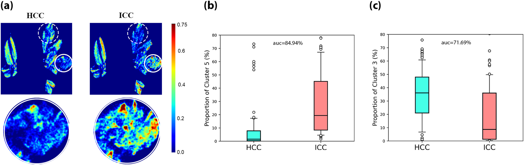 Fig. 6: Identification of polarization marker for distinguishing HCC and ICC.