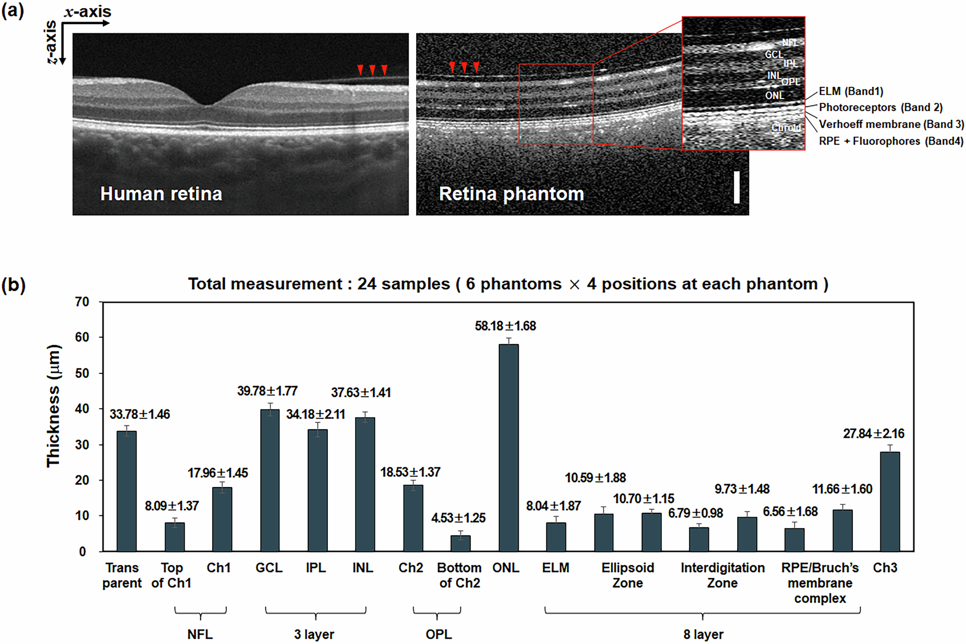 Fig. 5: Representation of retinal morphology in the retinal phantom.