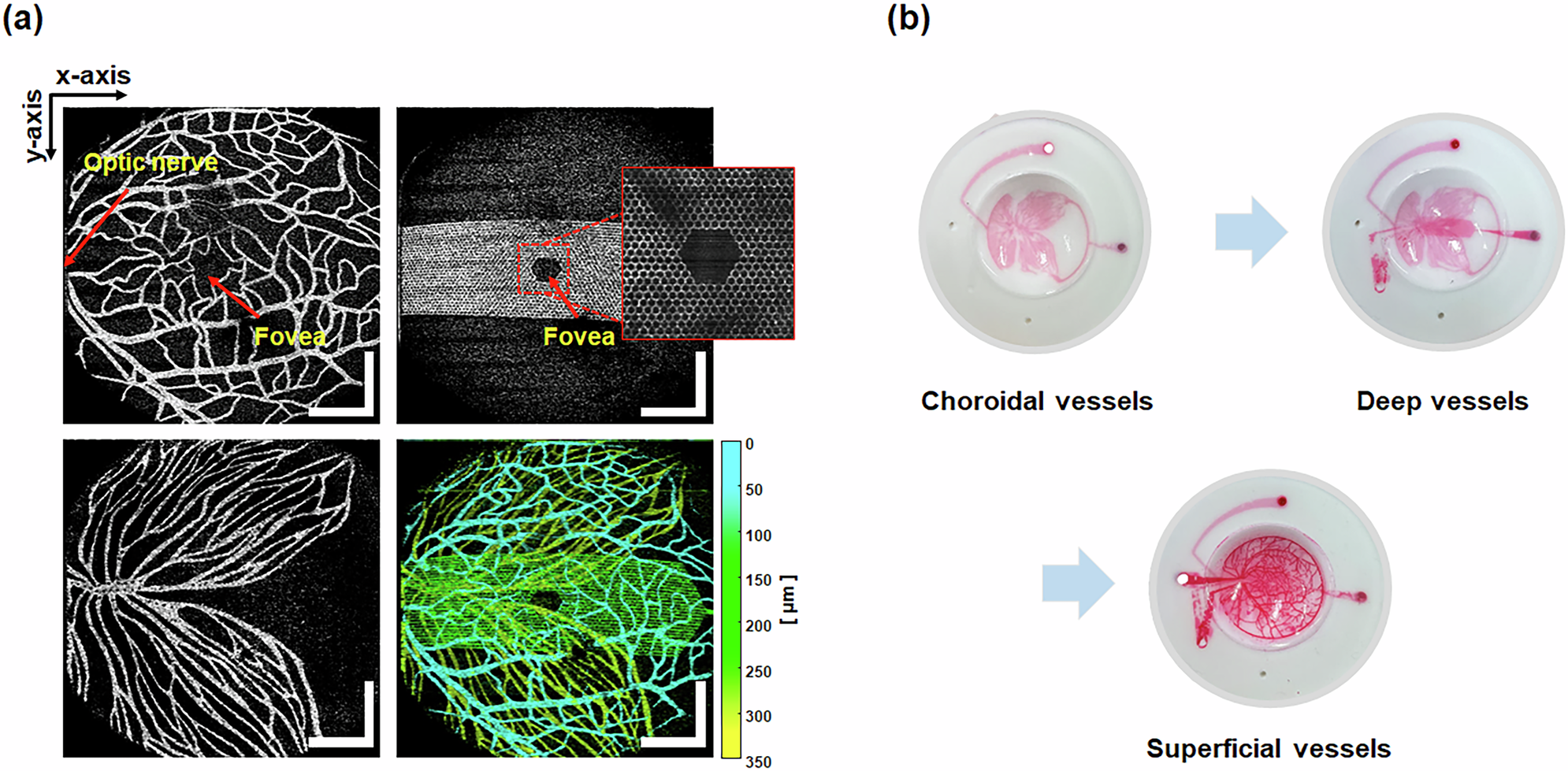 Fig. 8: Acquisition of OCTA en-face images of the phantom.