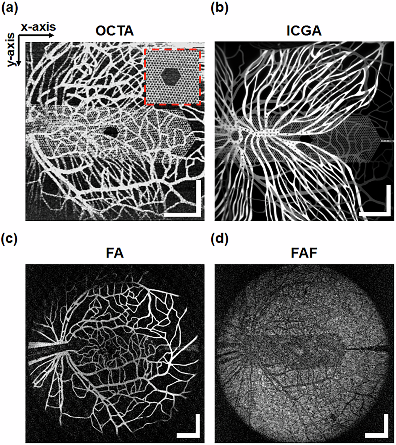 Fig. 9: En-face images of the retinal phantom obtained using commercial clinical ophthalmologic imaging systems.