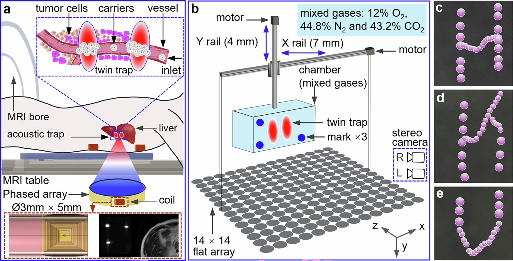 Fig. 1: Envisioned medical potential of MRI-guided acoustic trapping, our hardware architecture, and demonstrated functionalities.