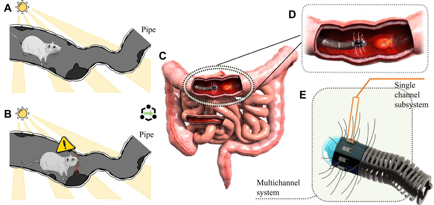 Tactile perception: a biomimetic whisker-based method for clinical  gastrointestinal diseases screening