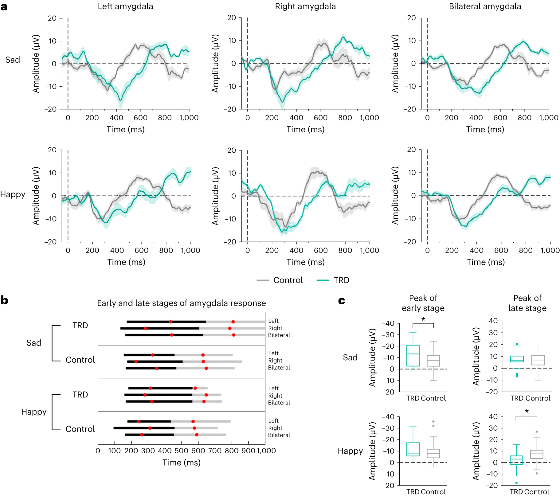 Fig. 2: Amygdala iERP response to sad and happy faces.
