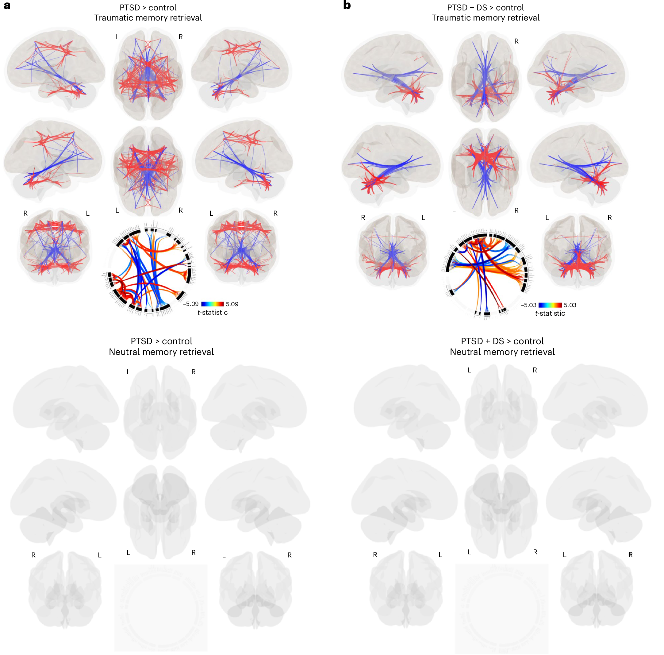 Reduced cerebello-thalamo-cortical functional connectivity during traumatic  memory retrieval in PTSD | Nature Mental Health, image size:2165x2135