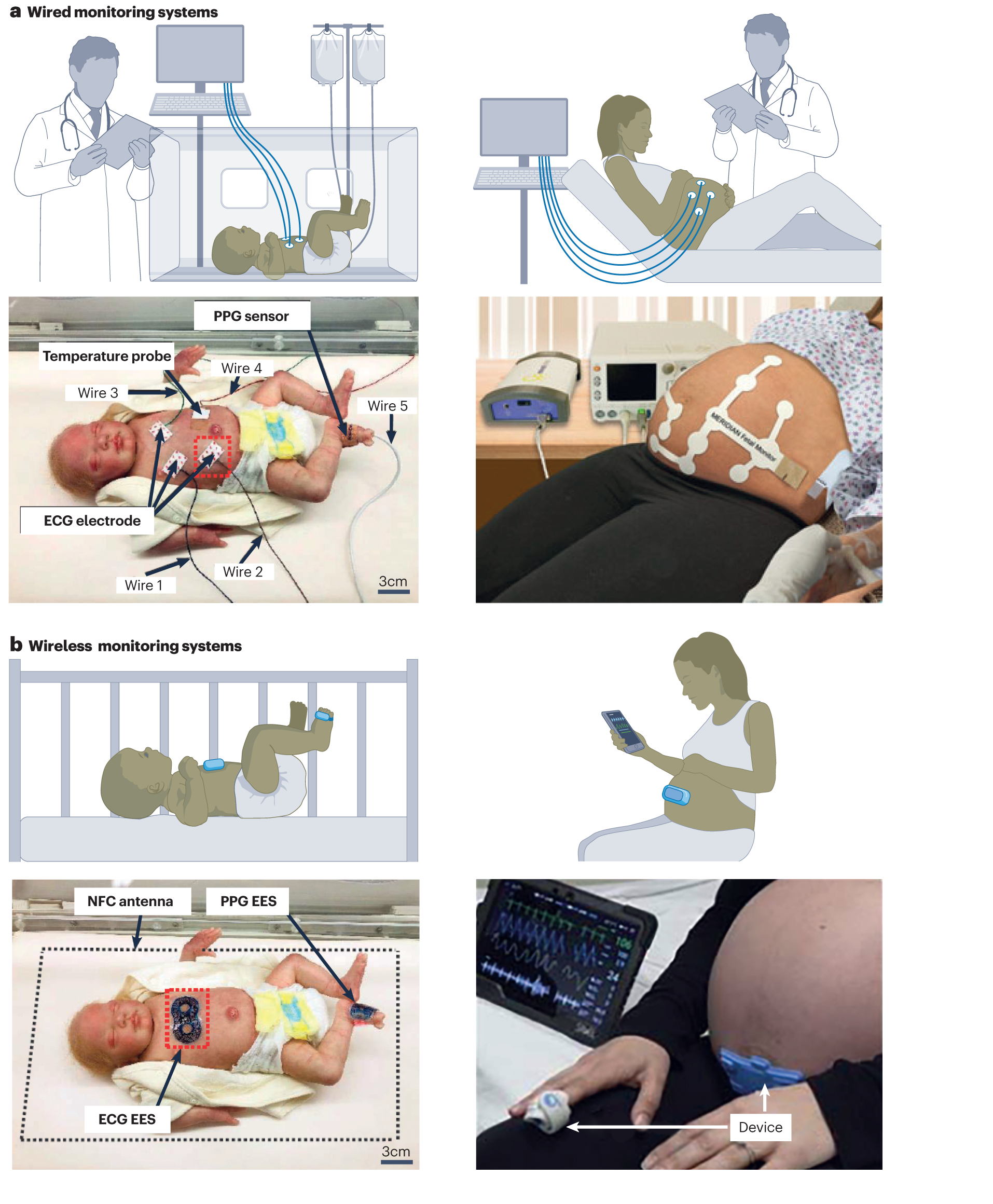 Northwestern Team Develops Wireless Monitors for Pregnant Moms