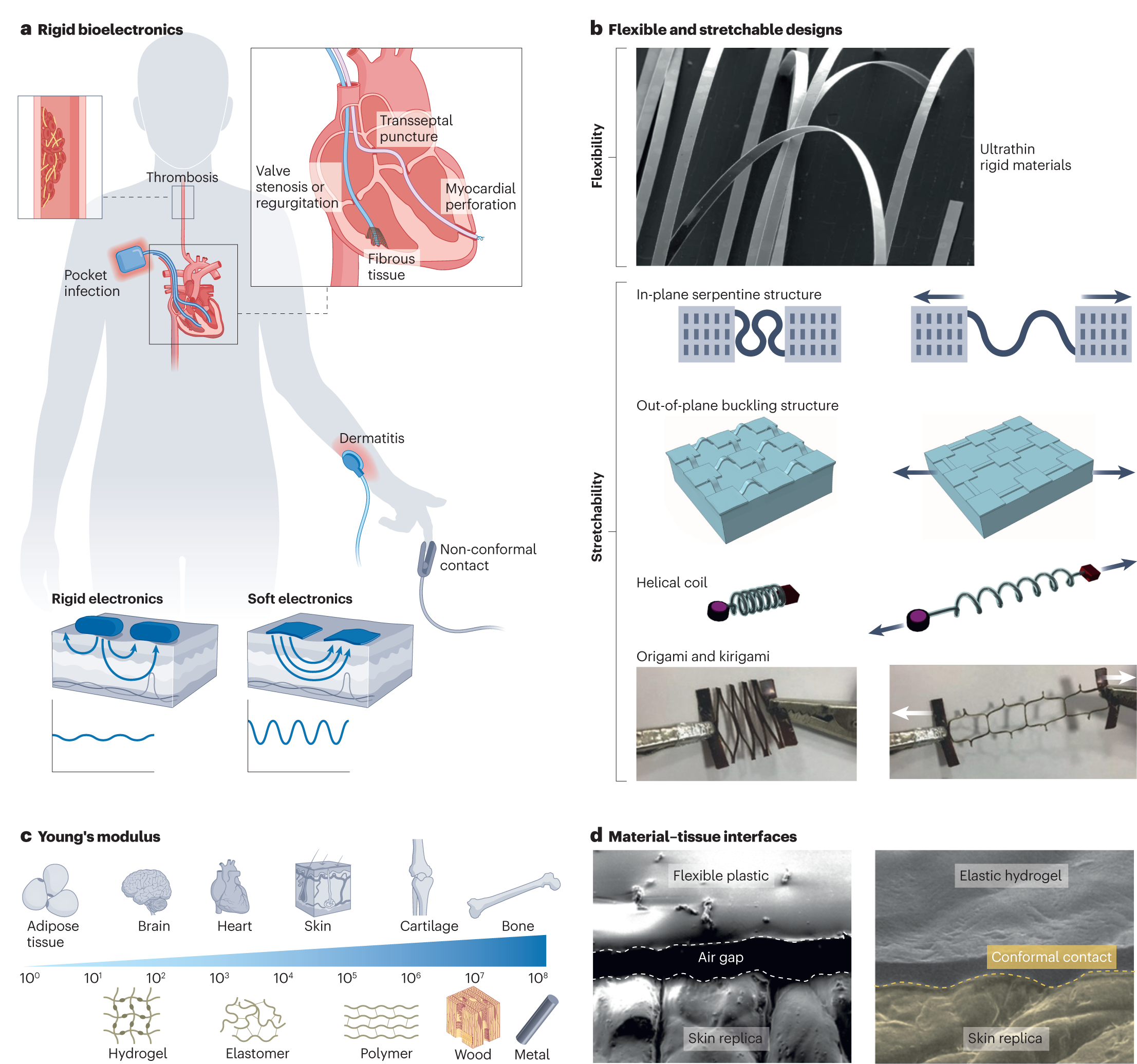 Soft bioelectronics for the management of cardiovascular diseases