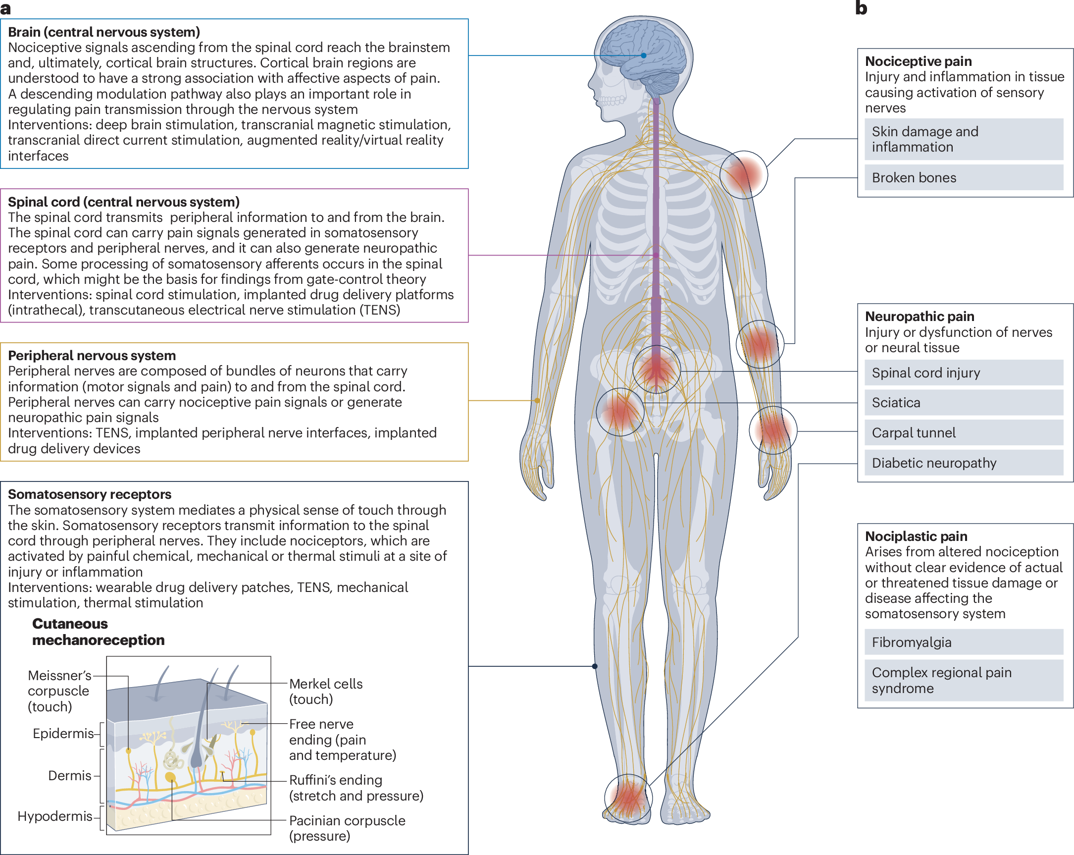 Bioelectronics for targeted pain management | Nature Reviews 