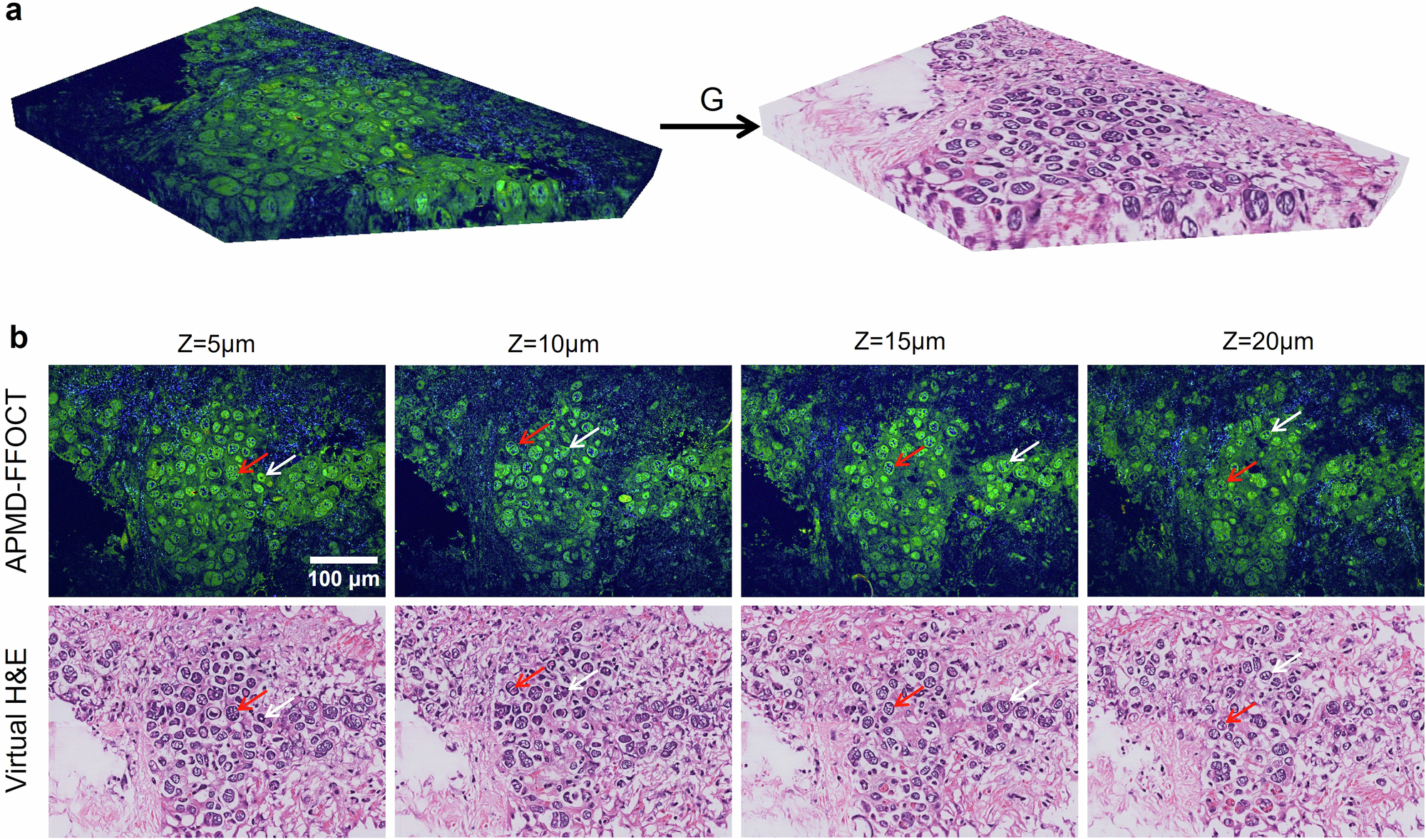 Fig. 7: Virtual H&E Staining of 3D tomographic images.